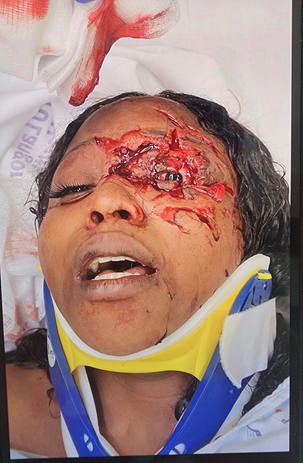 Help Ahykra Jackson Heal and Care for Her Kids campaign photo, 4 of 6