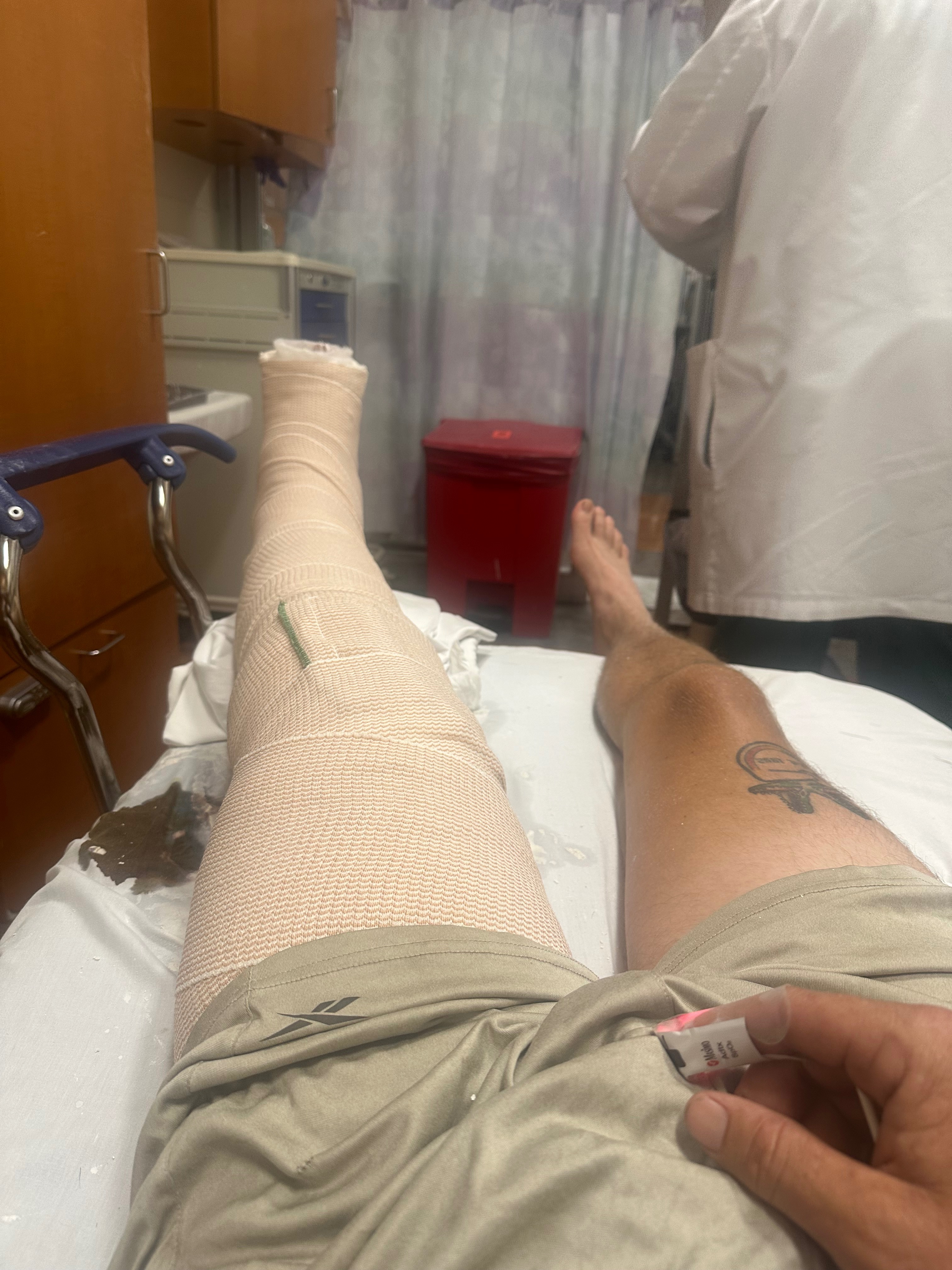 Help for Brandon to get Surgery After Scooter Accident campaign photo, 2 of 4