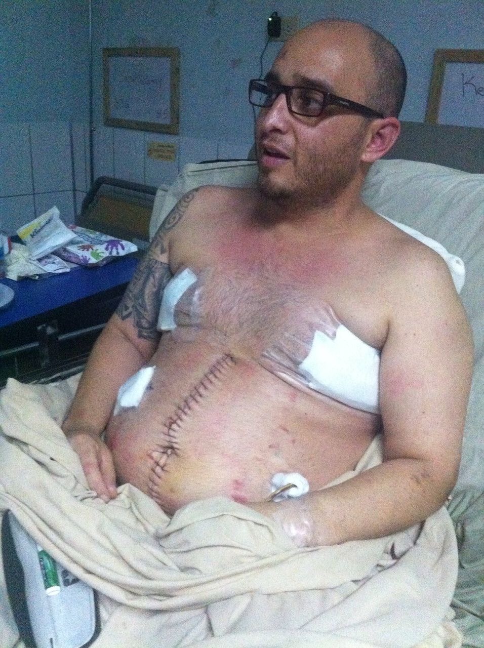 Help Keneth Walk Again After 13 Surgeries campaign photo, 2 of 8