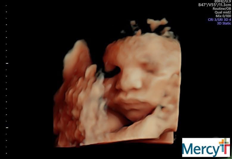 Help Melissa's Family: Unpaid Maternity Crisis campaign photo, 2 of 7