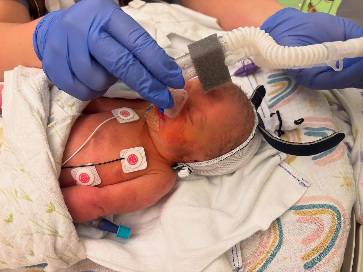 Support Baby Laurel's Medical Journey campaign photo, 2 of 6
