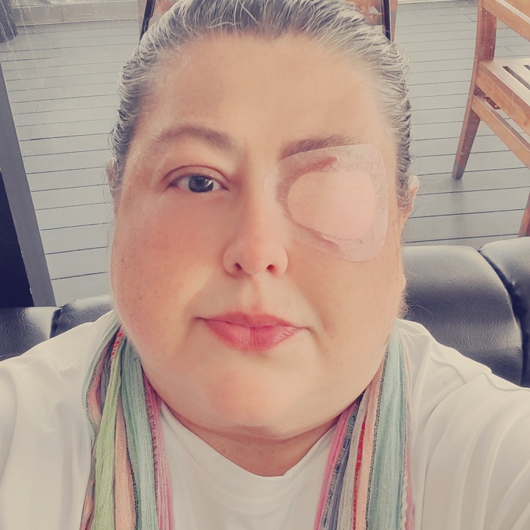 Es urgente por desgracia que me saquen mi ojo derecho campaign photo, 2 of 4