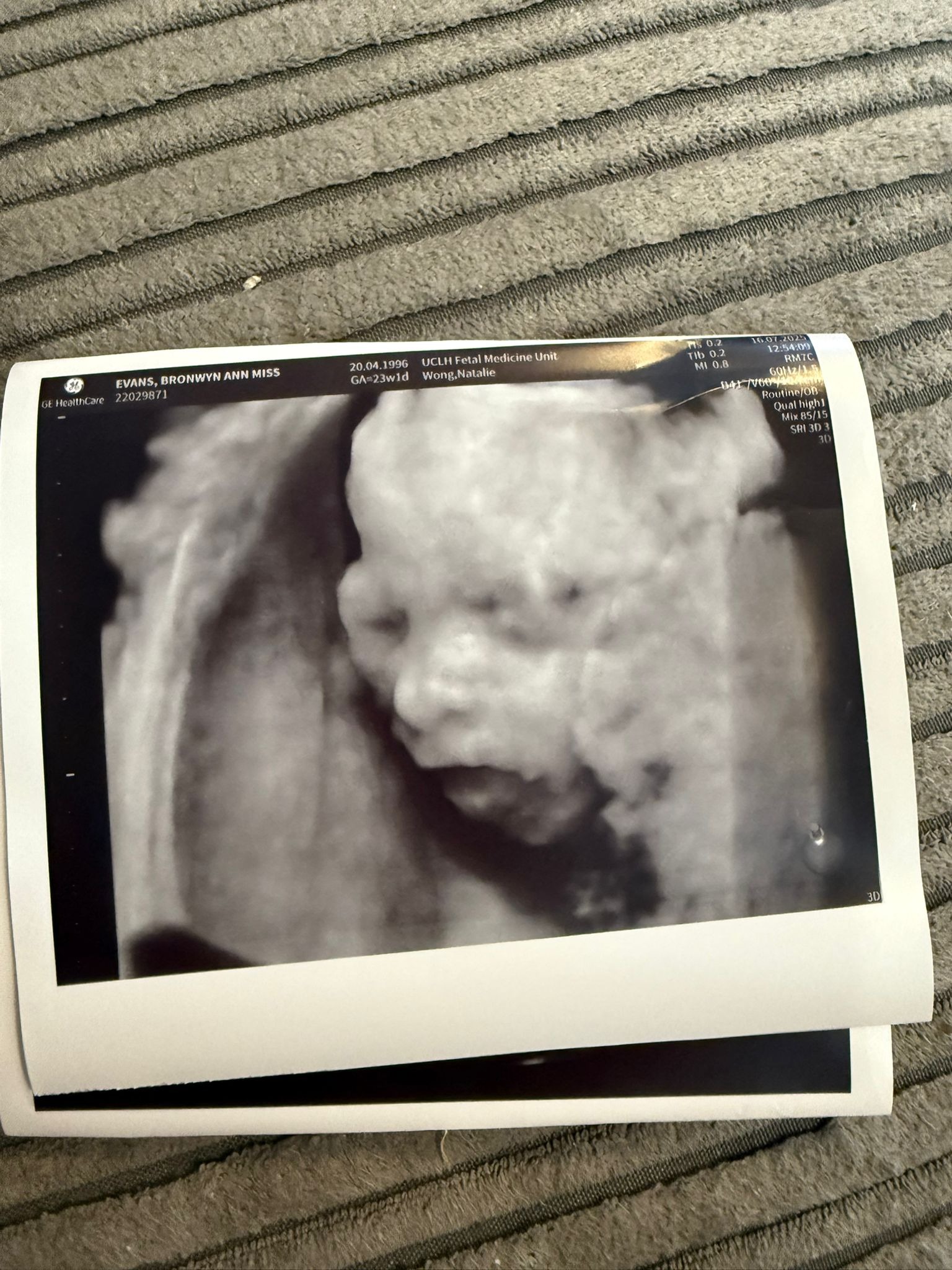 Our beautiful unborn granddaughter has Spina Bifida campaign photo, 2 of 4