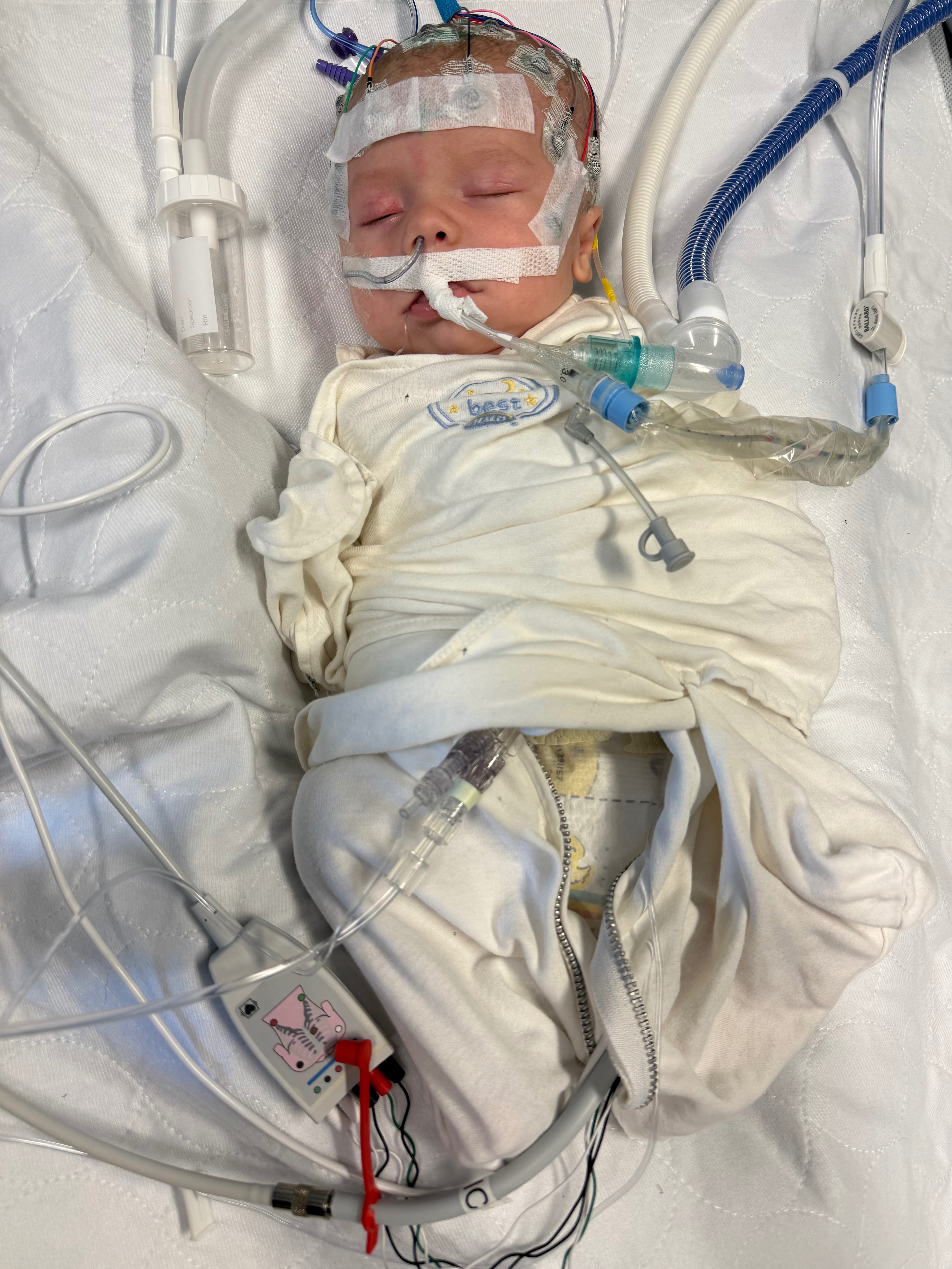 Support Baby Lawson's Fight Against Brain Tumor campaign photo, 2 of 4