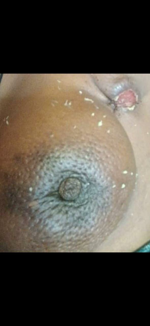 Support Marquise's Urgent Cancer Surgery campaign photo, 4 of 7