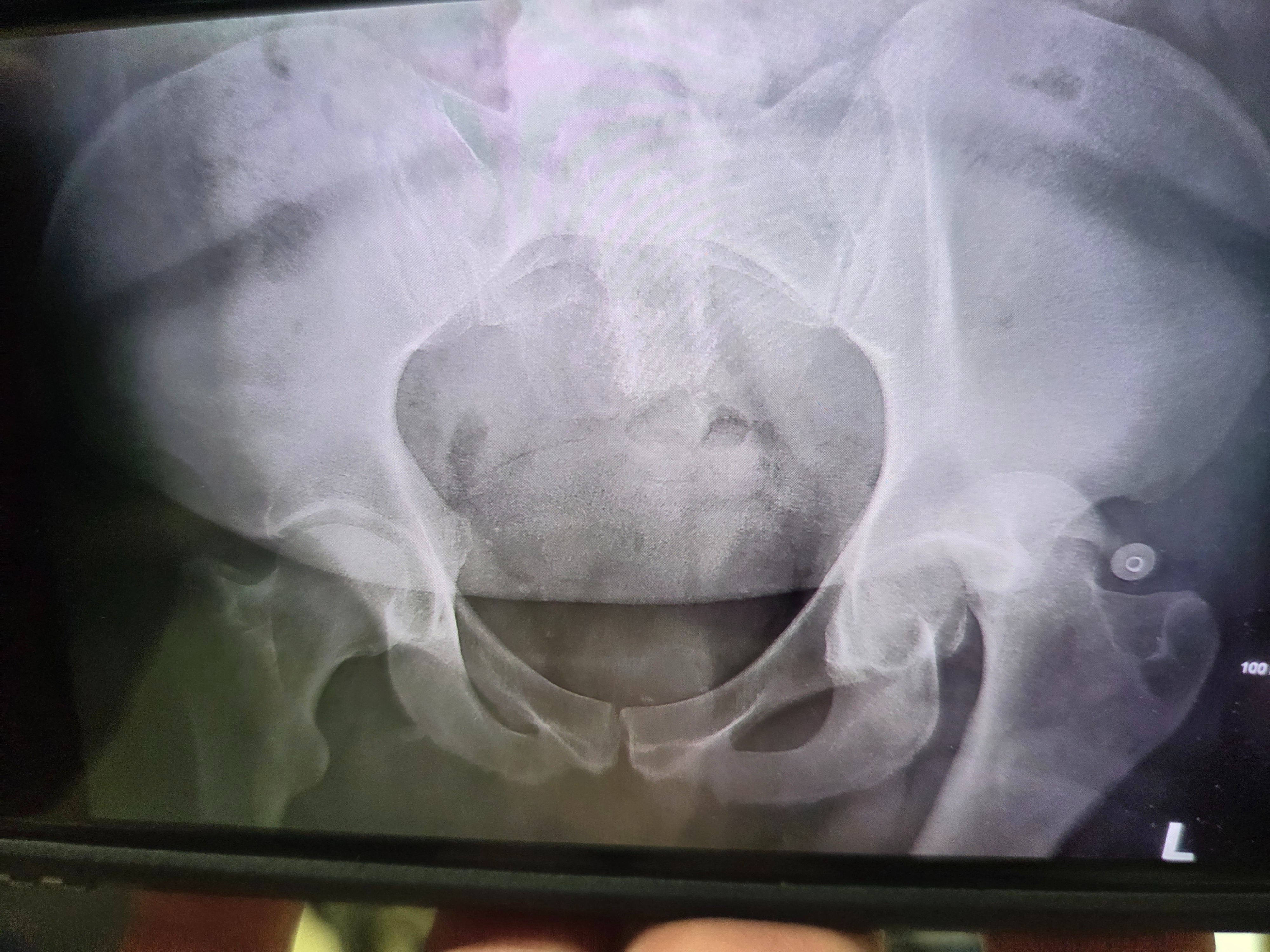 Help Julian Ochoa Recover from Severe Injury campaign photo, 6 of 7