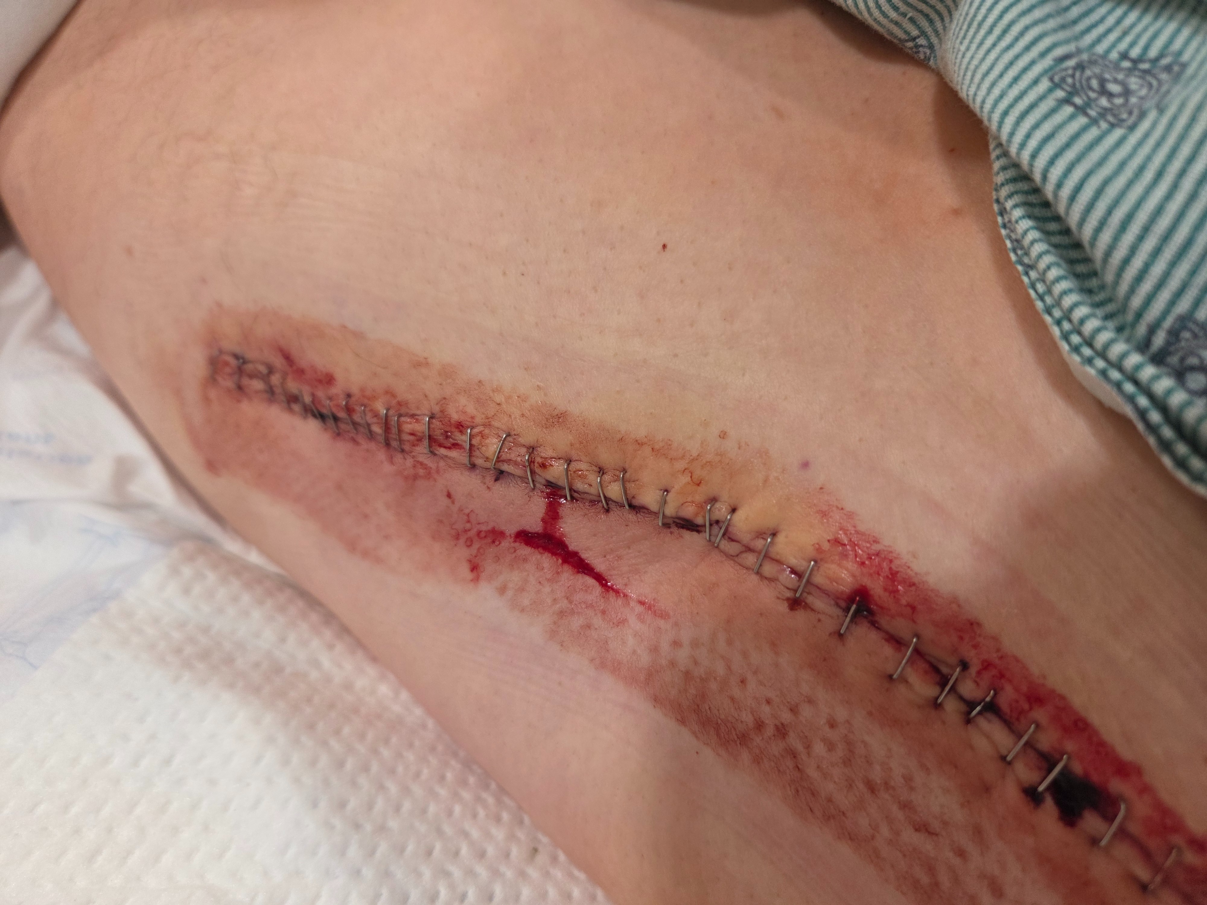 Help Julian Ochoa Recover from Severe Injury campaign photo, 4 of 7