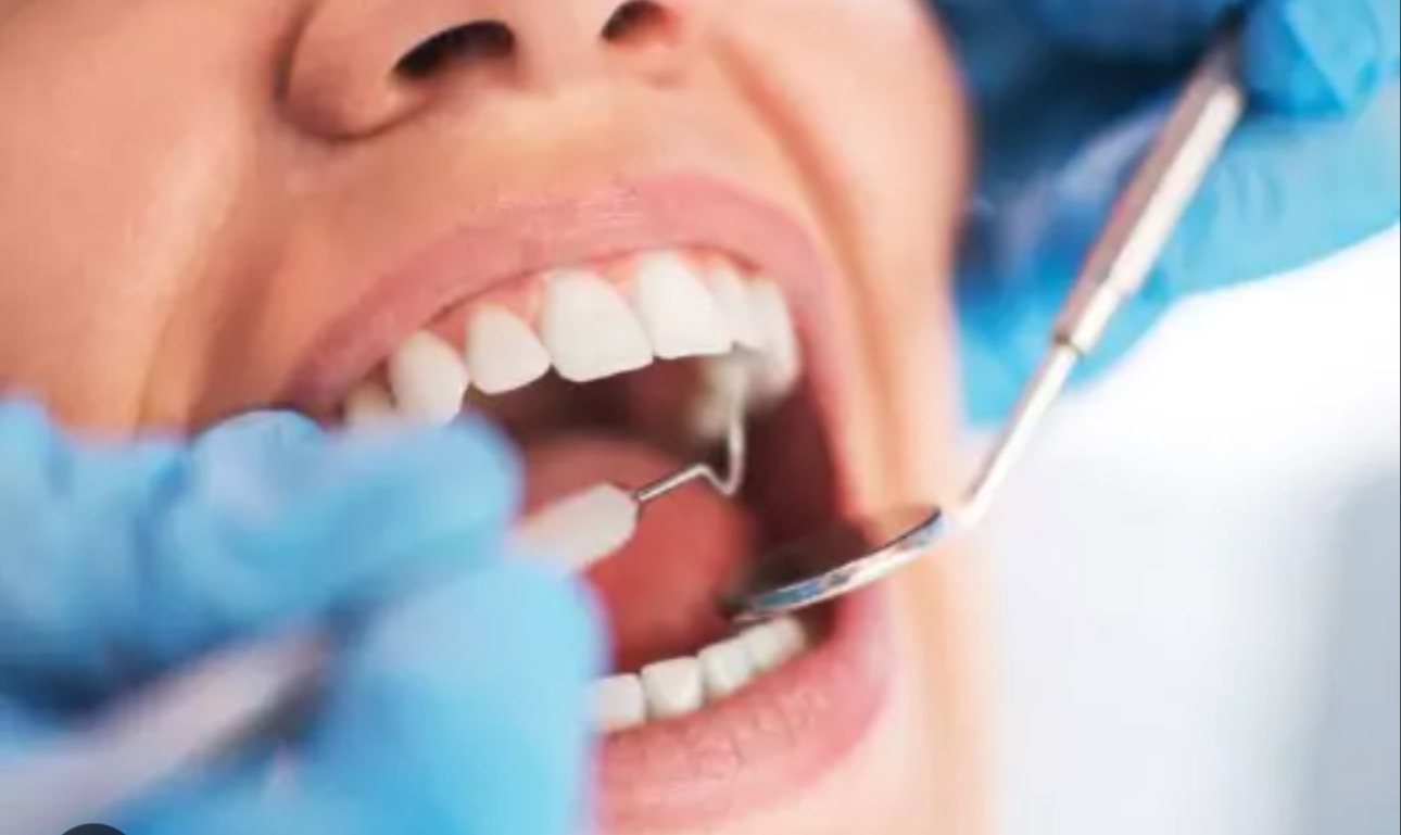 Support Susan’s Dental Surgery Journey. campaign photo, 2 of 4