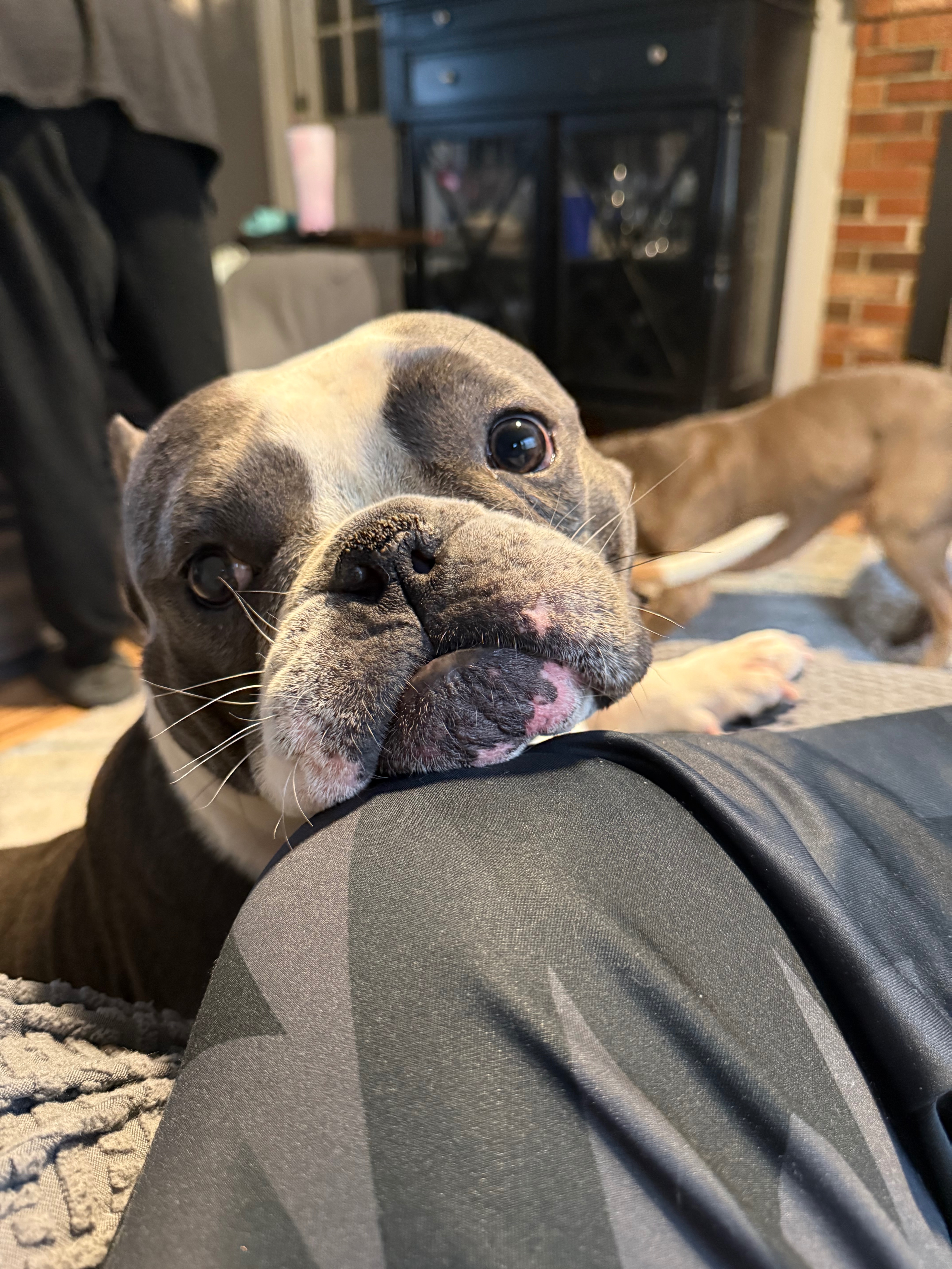 Help Our Little Boy Overcome His Health Crisis campaign photo, 4 of 5