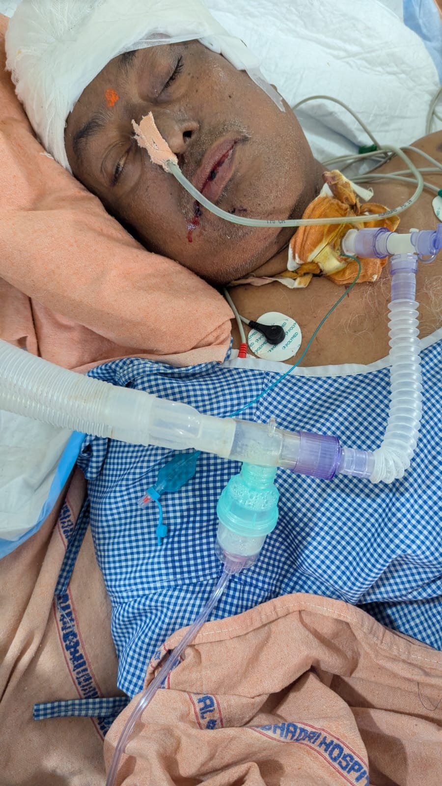 Assist Subhadra's Family After ICU Tragedy campaign photo, 4 of 5