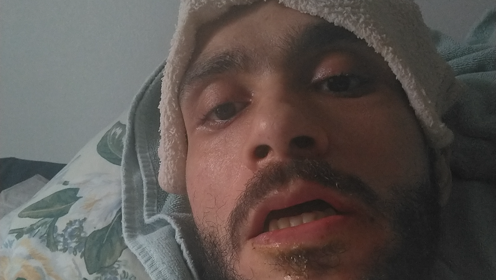 Help with scooter & medical services and no insurance photo