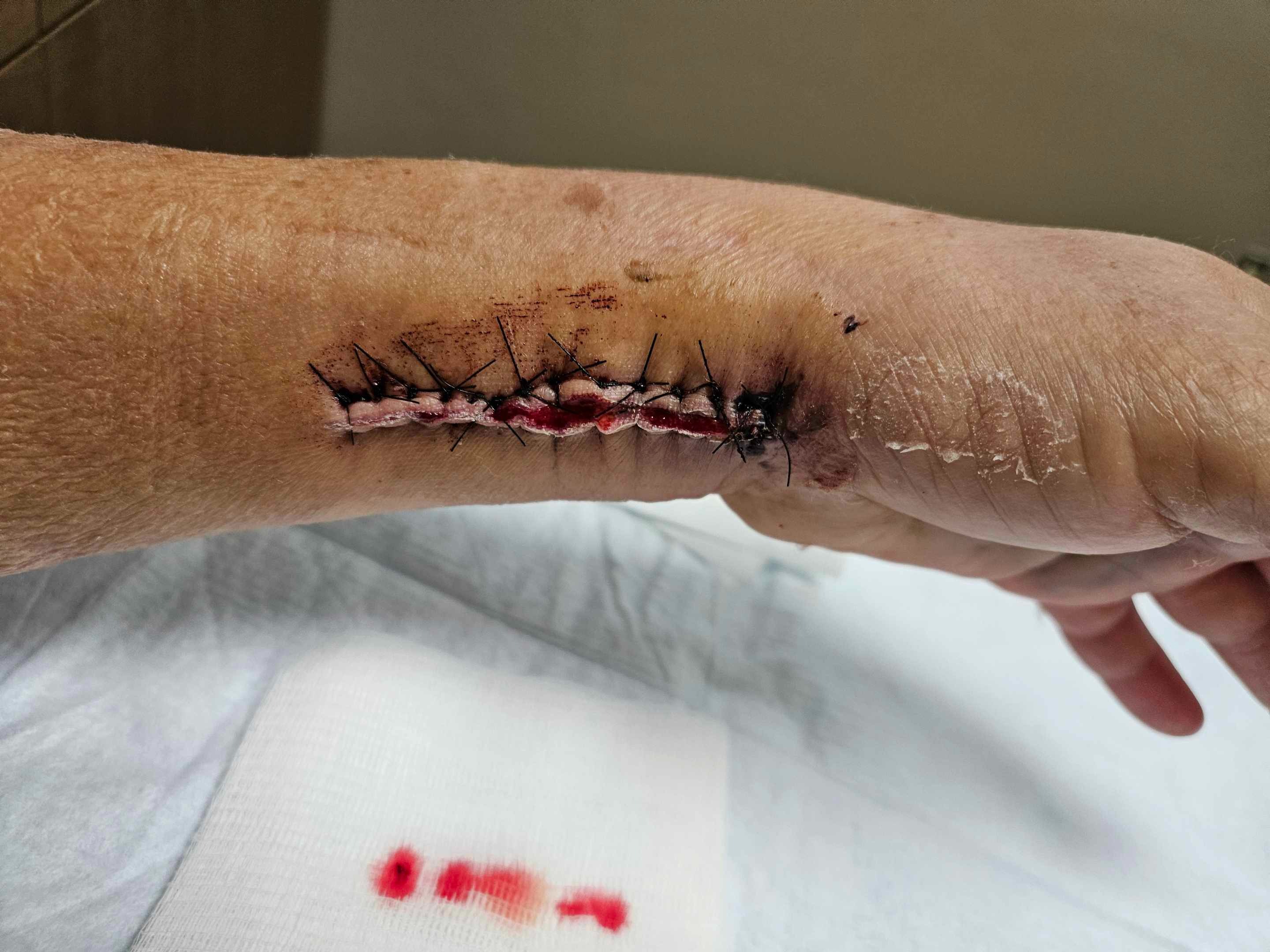 HELP with Medical Bills - Unable to Work campaign photo, 4 of 8
