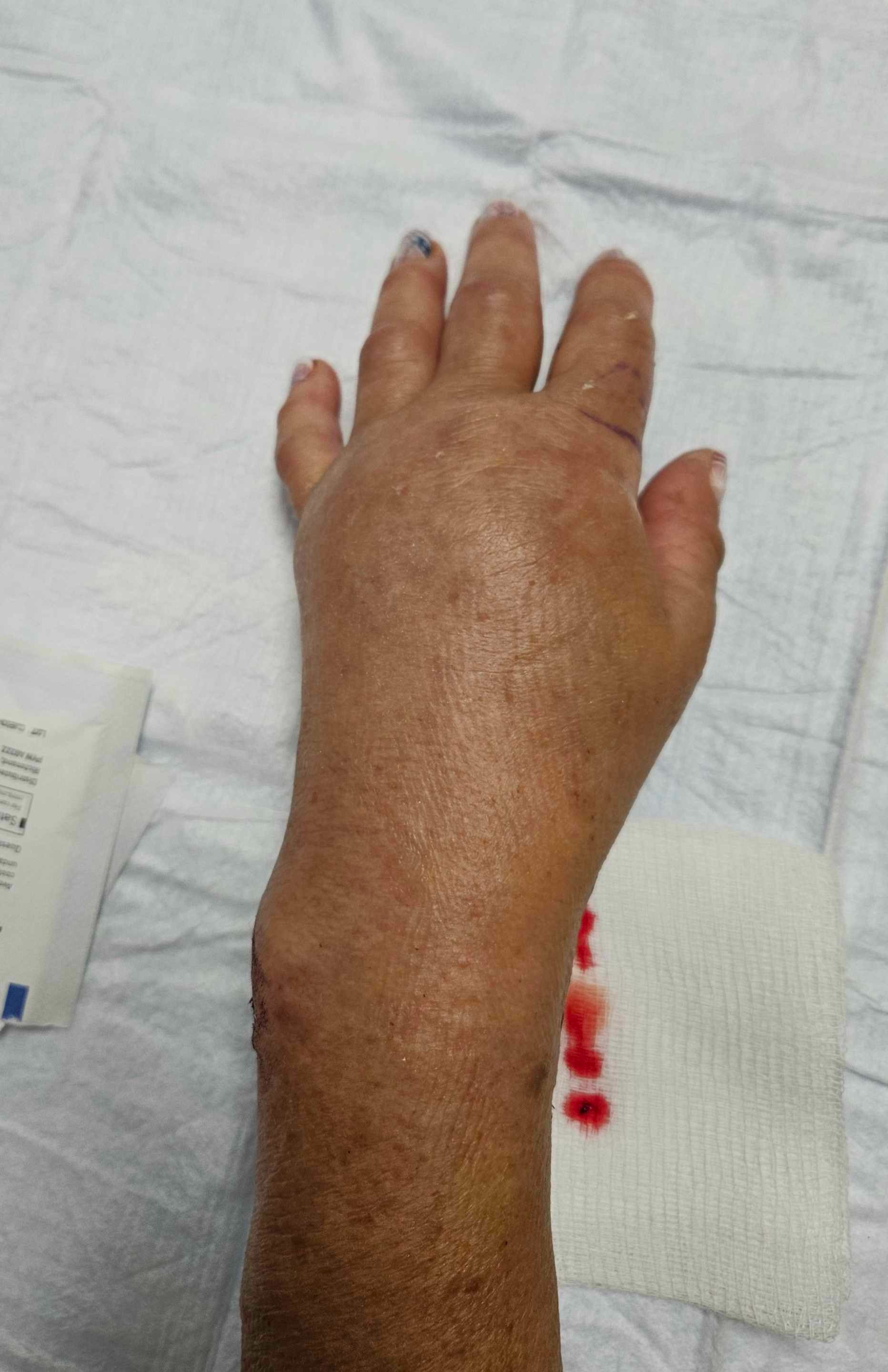 HELP with Medical Bills - Unable to Work campaign photo, 6 of 8