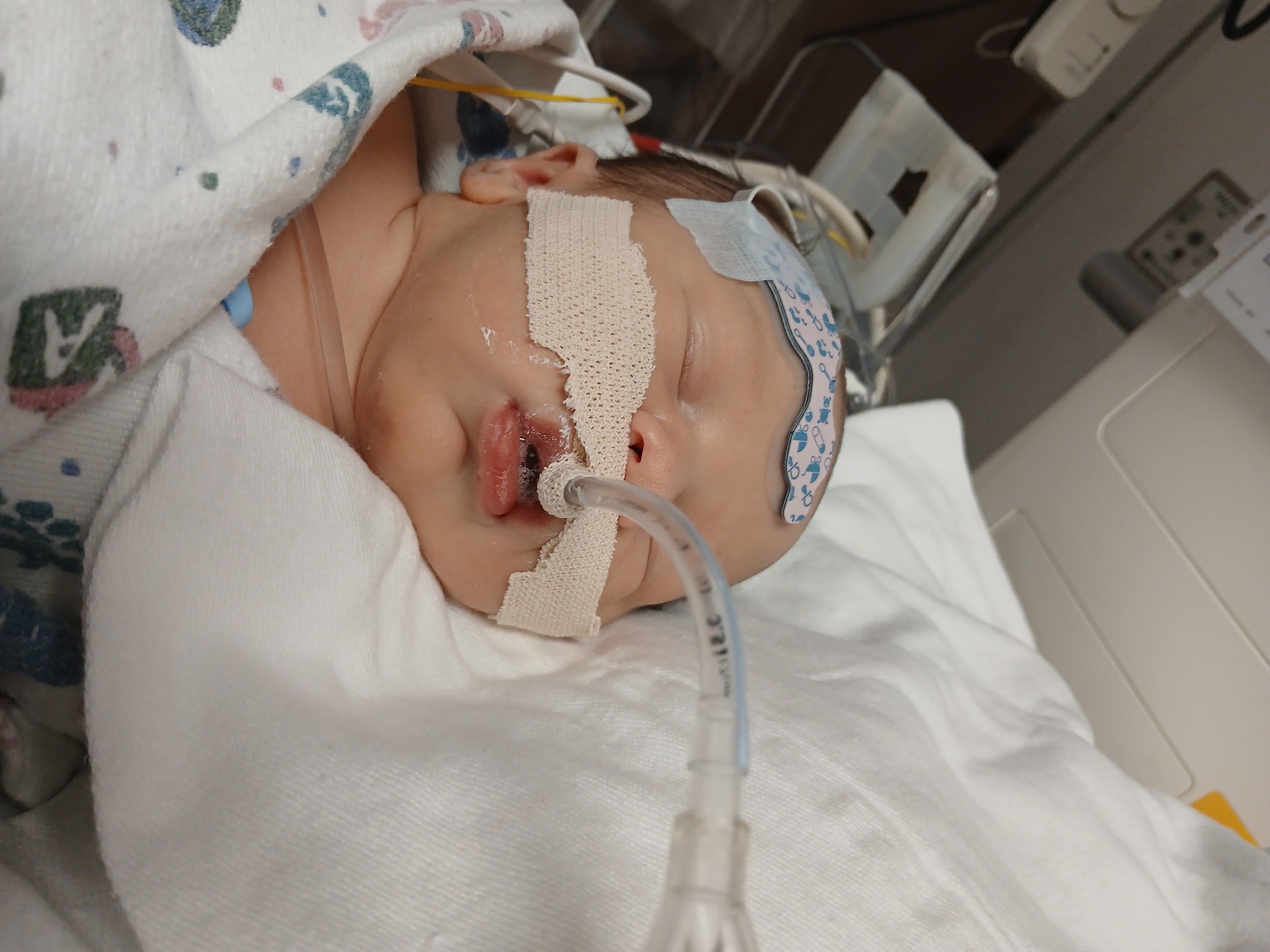 Support Derek's Heart Surgery Journey campaign photo, 2 of 5