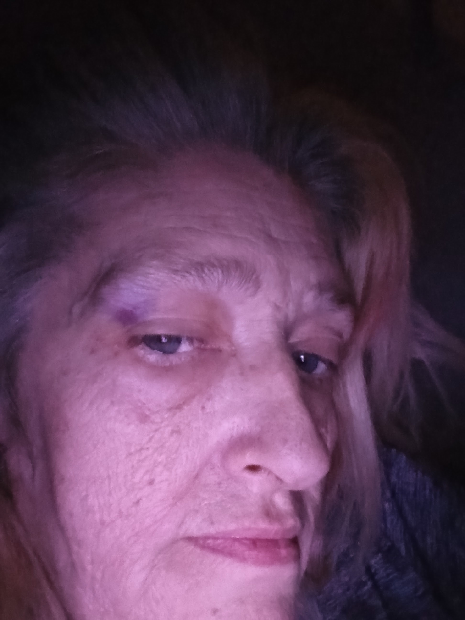 Tumor Causing Seizures: I Need Your Help campaign photo, 2 of 4