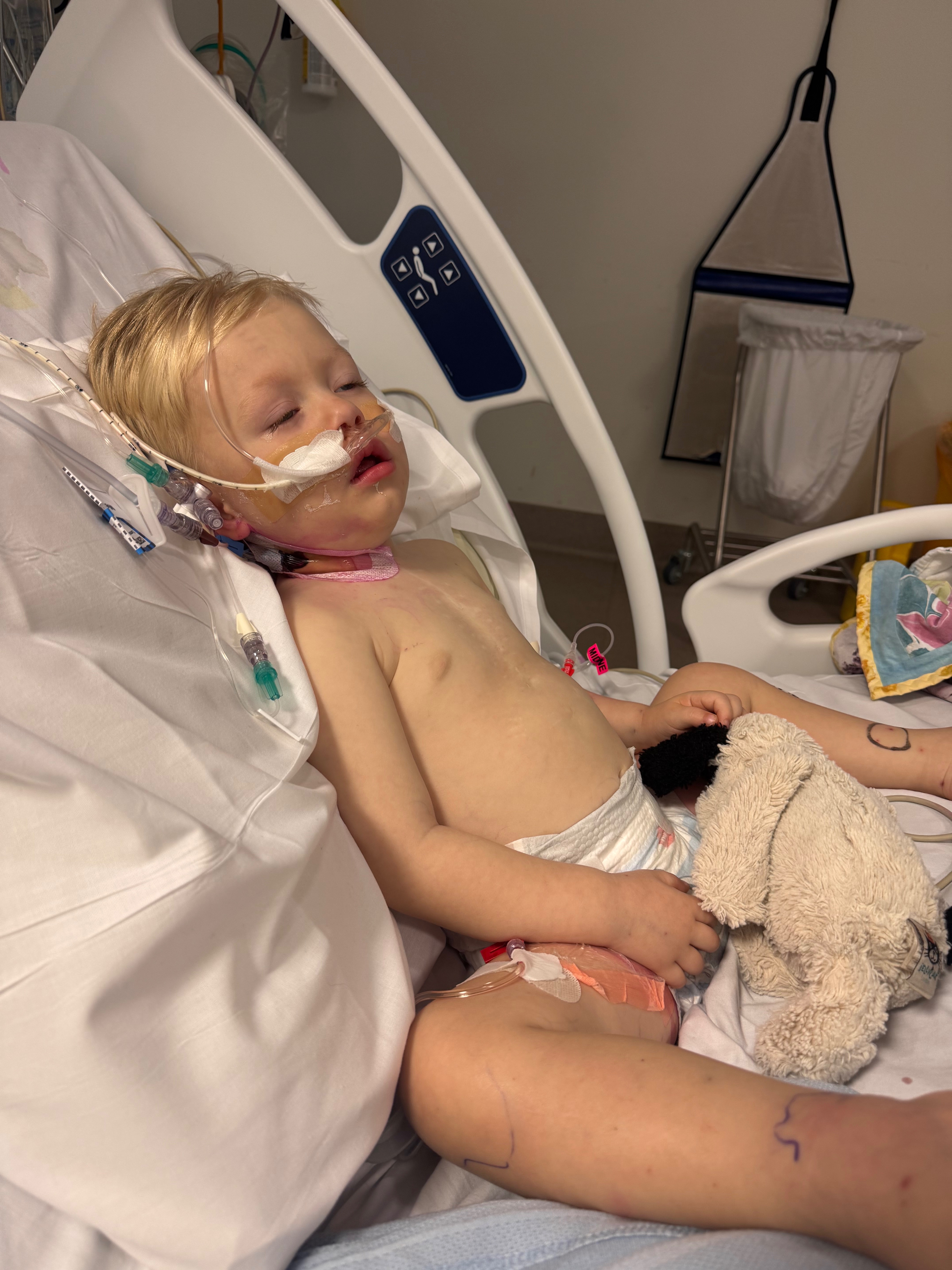 Help Baby Ted And Support Our Little Fighter Recover campaign photo, 4 of 8