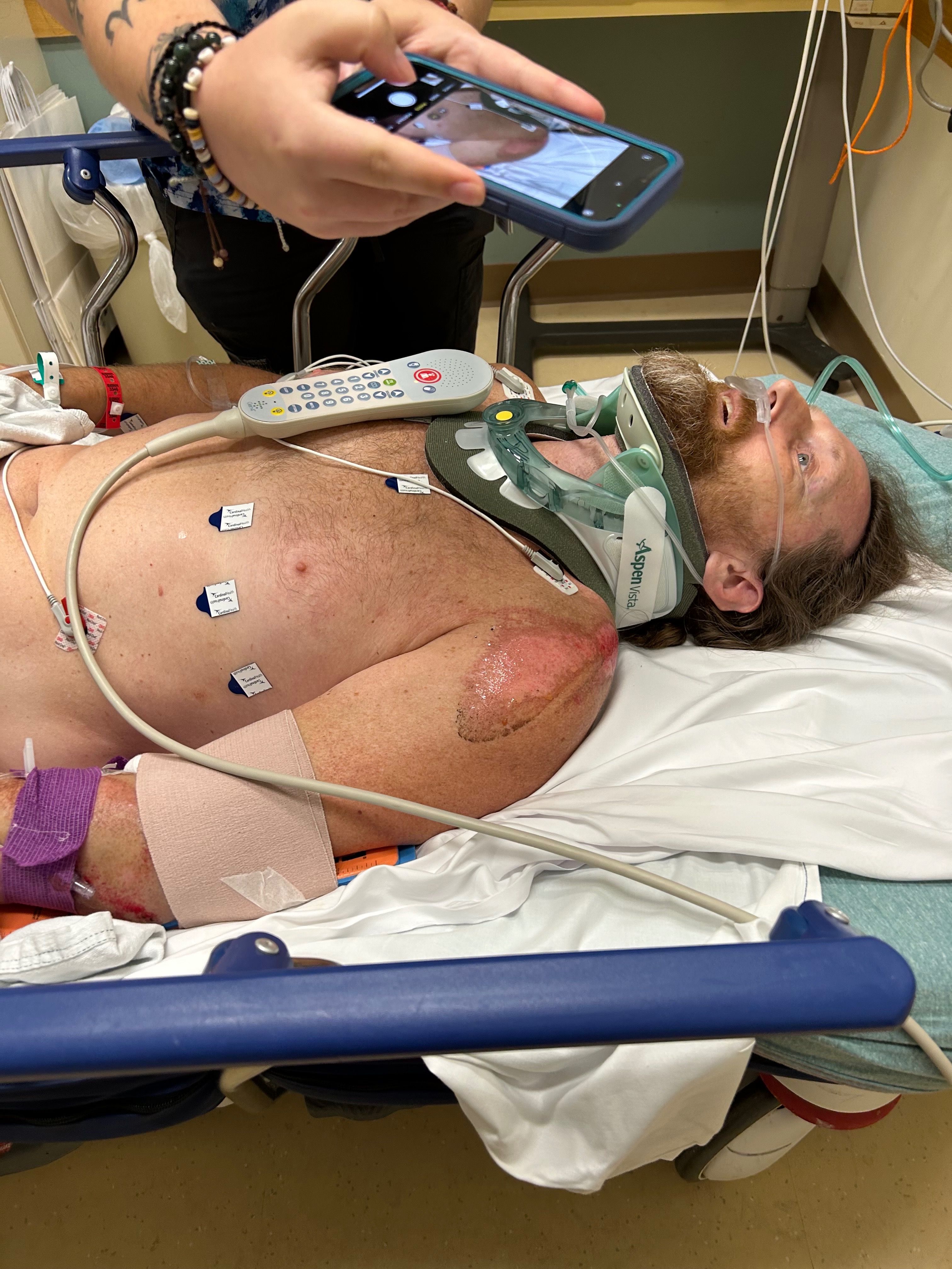 Urgent Help Needed for My Injured Nephews campaign photo, 4 of 5
