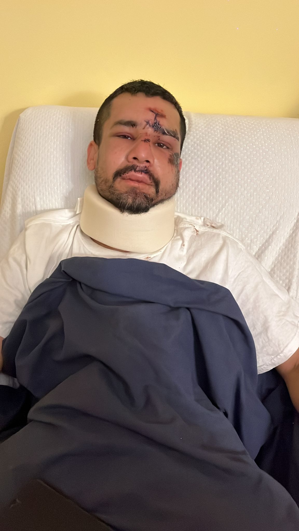 Help Wilder Recover from a NYC Subway Accident campaign photo, 2 of 4