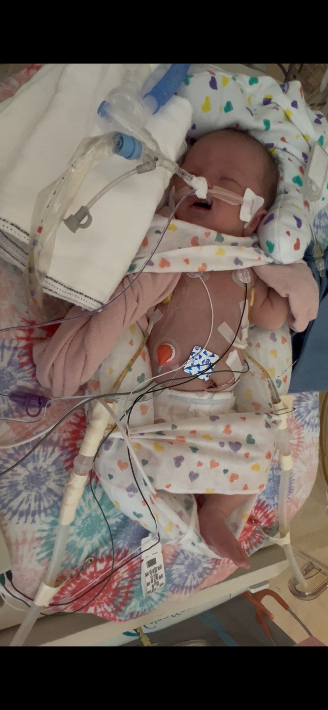 Aid Baby Evelyn's NICU Journey campaign photo, 2 of 4