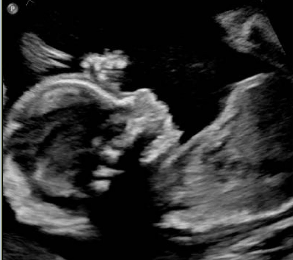 Help Our Baby Through a High-Risk Pregnancy campaign photo, 5 of 6