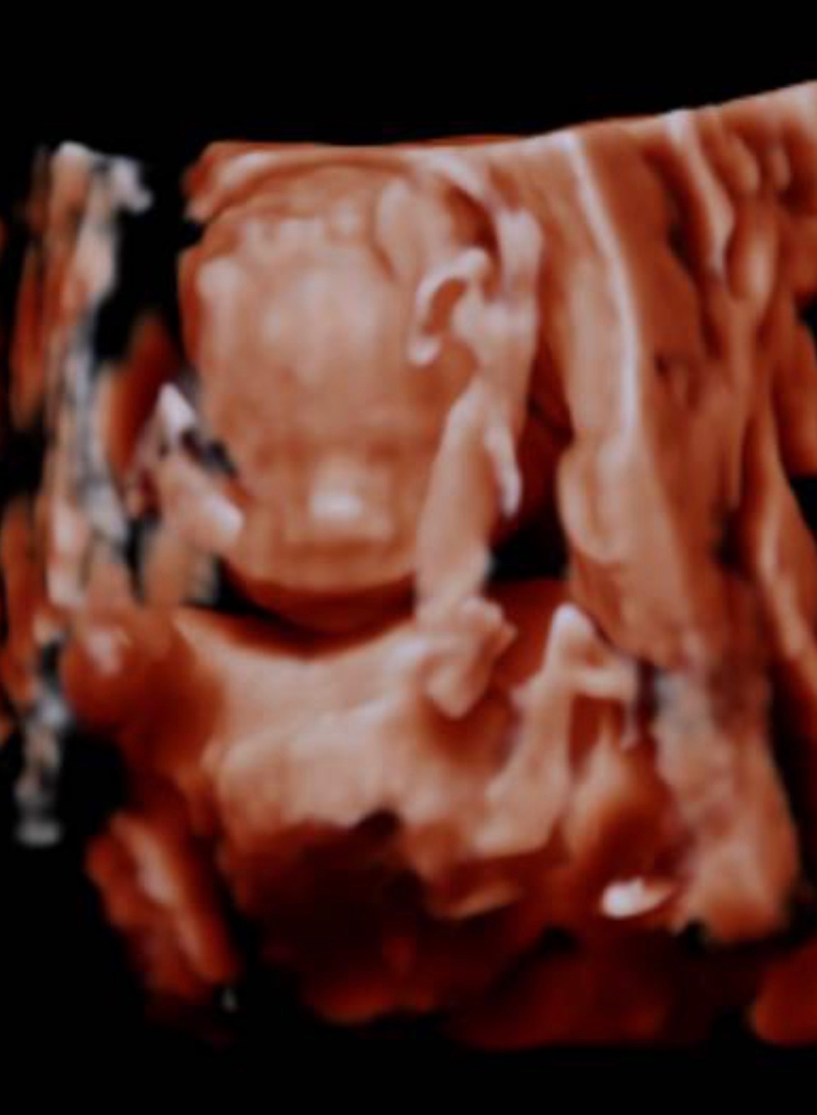Help Our Baby Through a High-Risk Pregnancy campaign photo, 2 of 6
