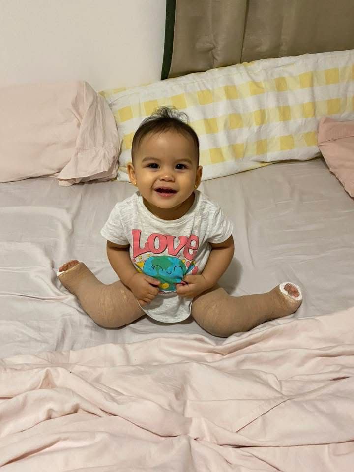 Help Alba Walk: Urgent Surgery Needed campaign photo, 7 of 8