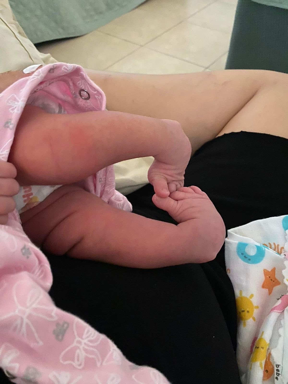 Help Alba Walk: Urgent Surgery Needed campaign photo, 5 of 8