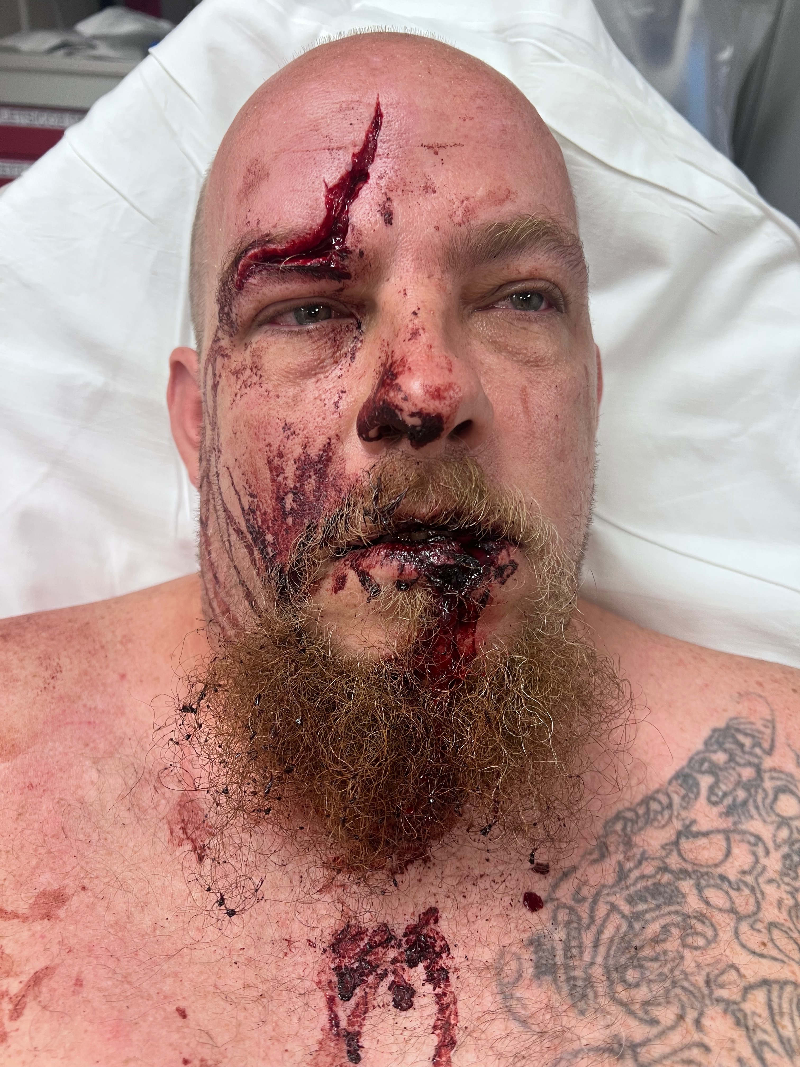 Hit and Run Victim Needs Your Support campaign photo, 4 of 5