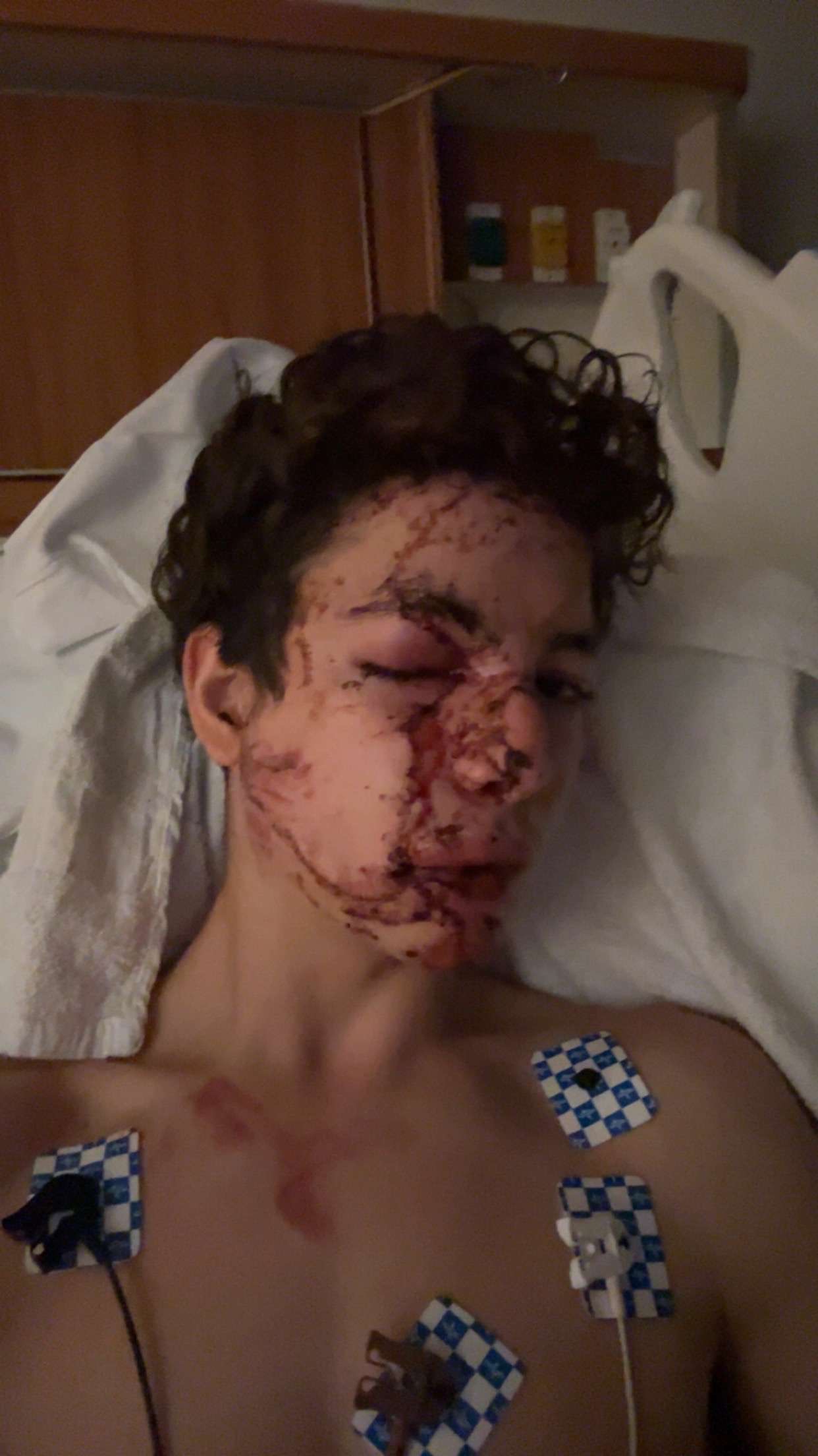 Help Josh Recover from Bike Accident Injuries campaign photo, 5 of 6