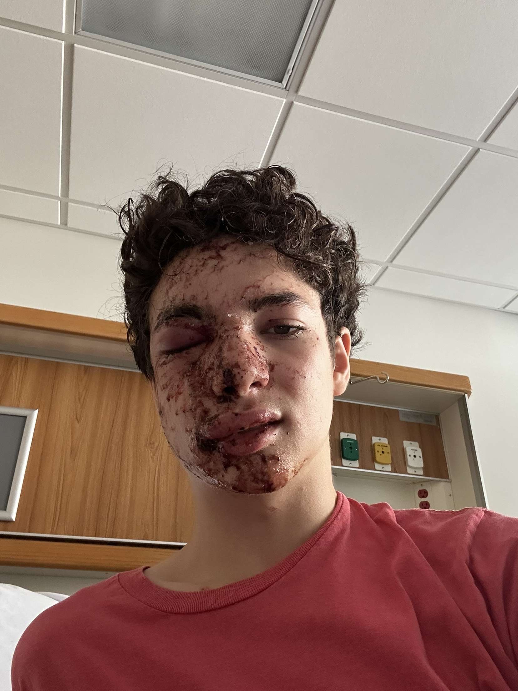 Help Josh Recover from Bike Accident Injuries campaign photo, 2 of 6
