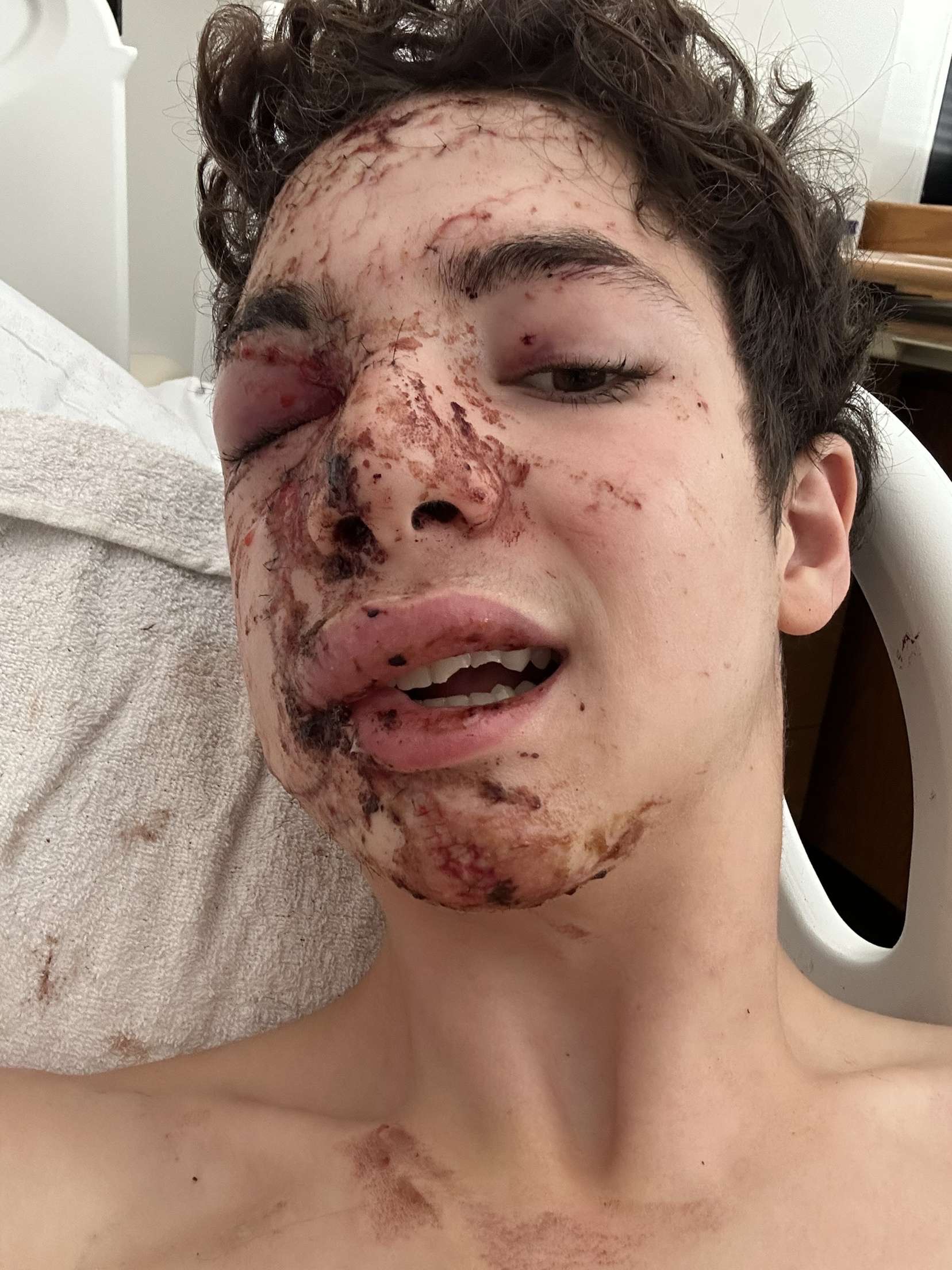 Help Josh Recover from Bike Accident Injuries campaign photo, 4 of 6