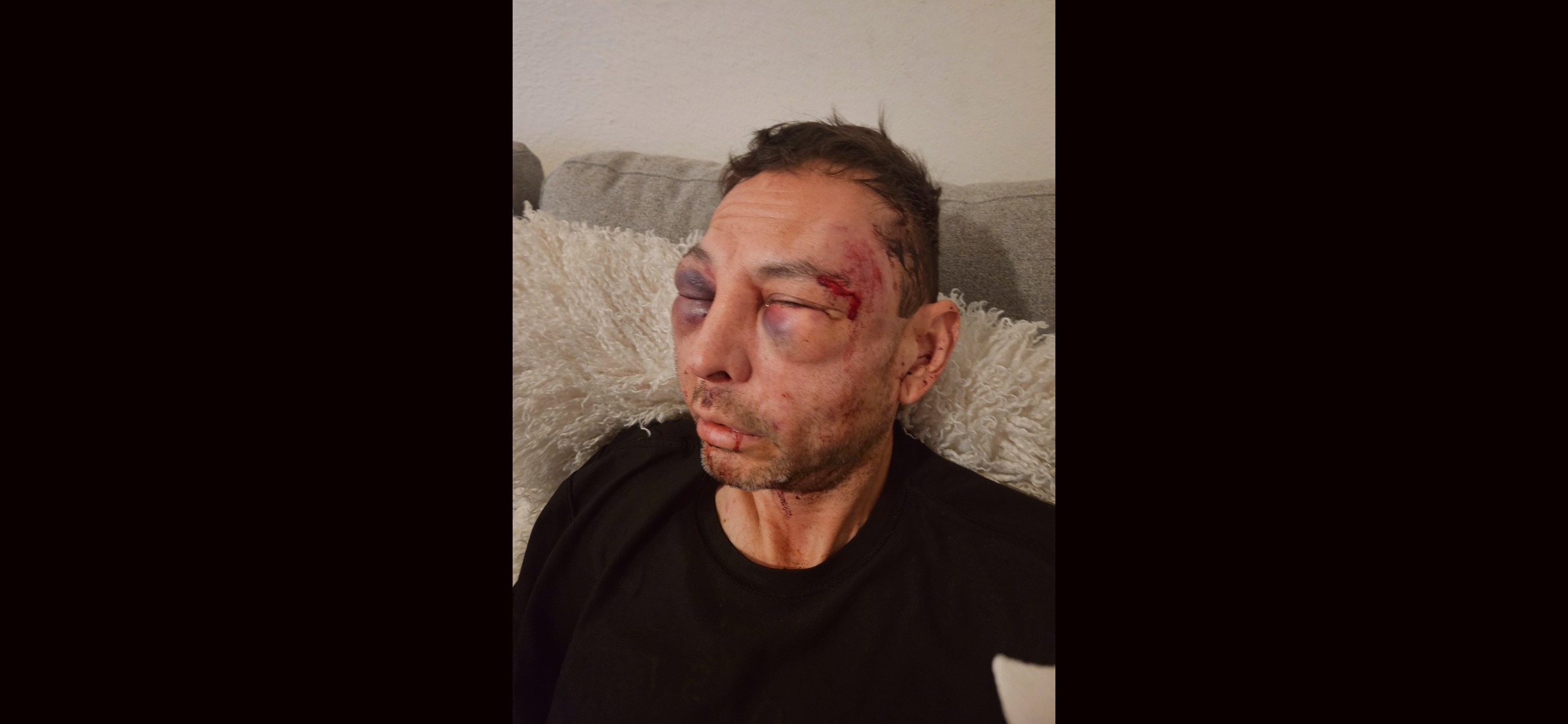 Help Star's Family Rebuild from Brutal Attack campaign photo, 2 of 4