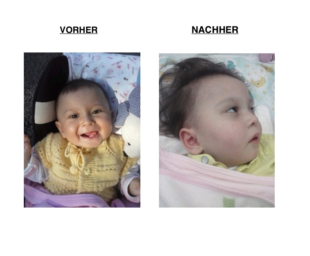 Schwerstbehinderung von Kind Elif campaign photo, 6 of 8