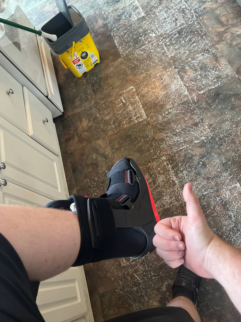 vavor broken ankle fund campaign photo, 5 of 6