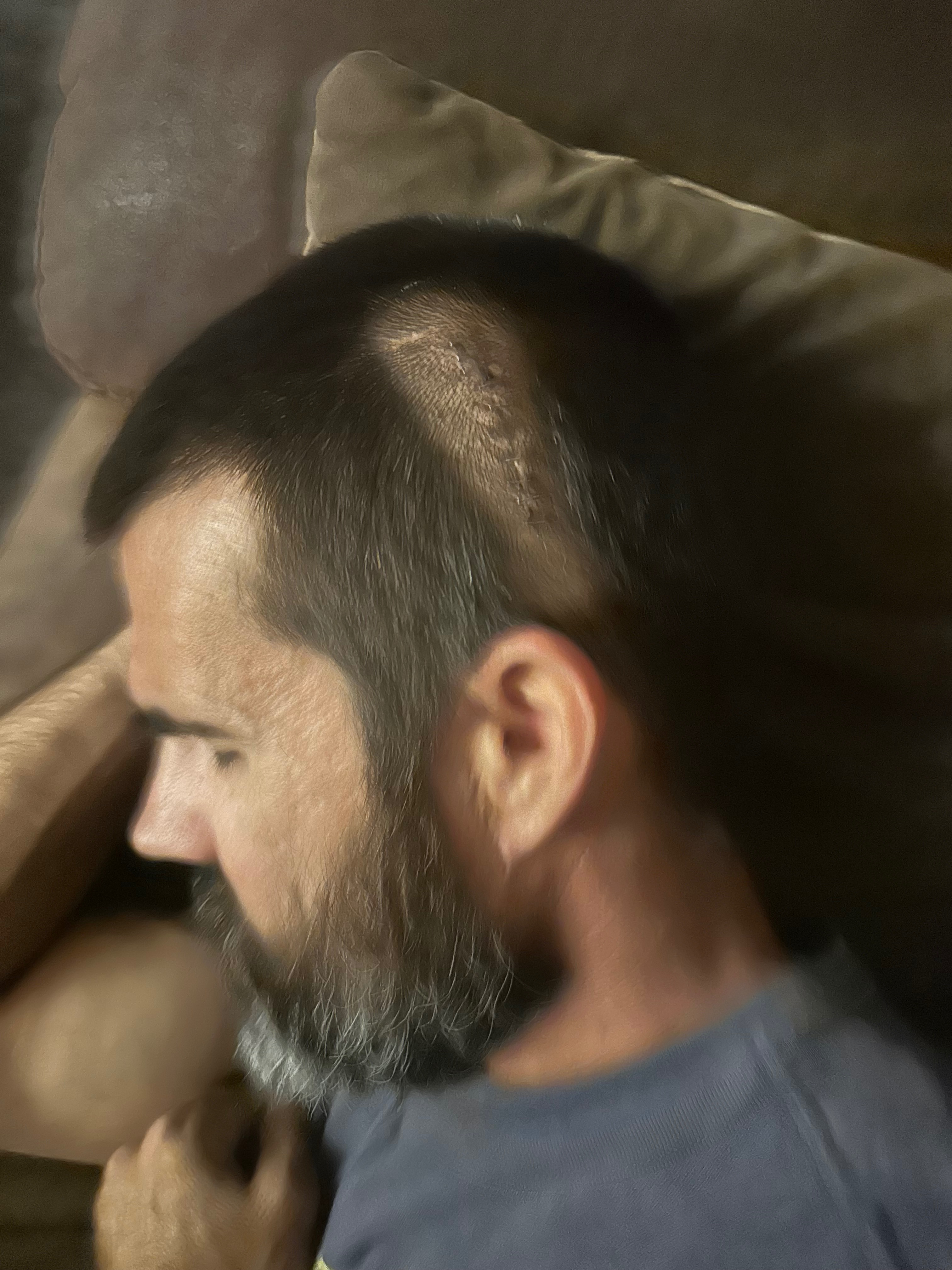 Support Michael's Recovery from Brain Surgery campaign photo, 7 of 8