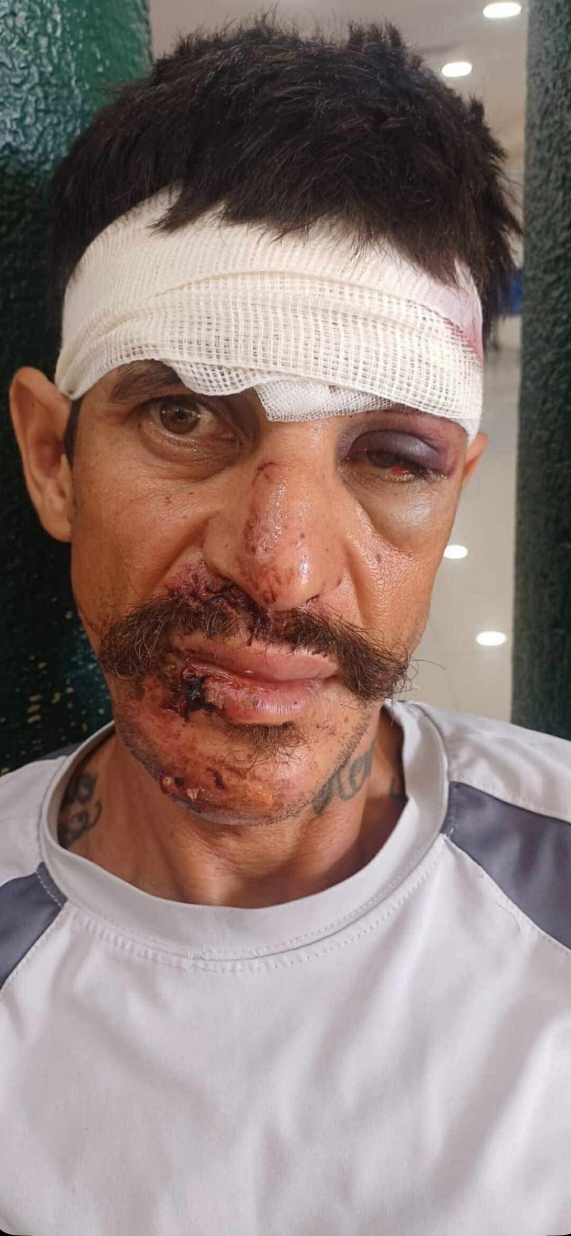 Ayuda para Salvar la Vida de Mi Hermano Tras un Accidente. campaign photo, 2 of 4