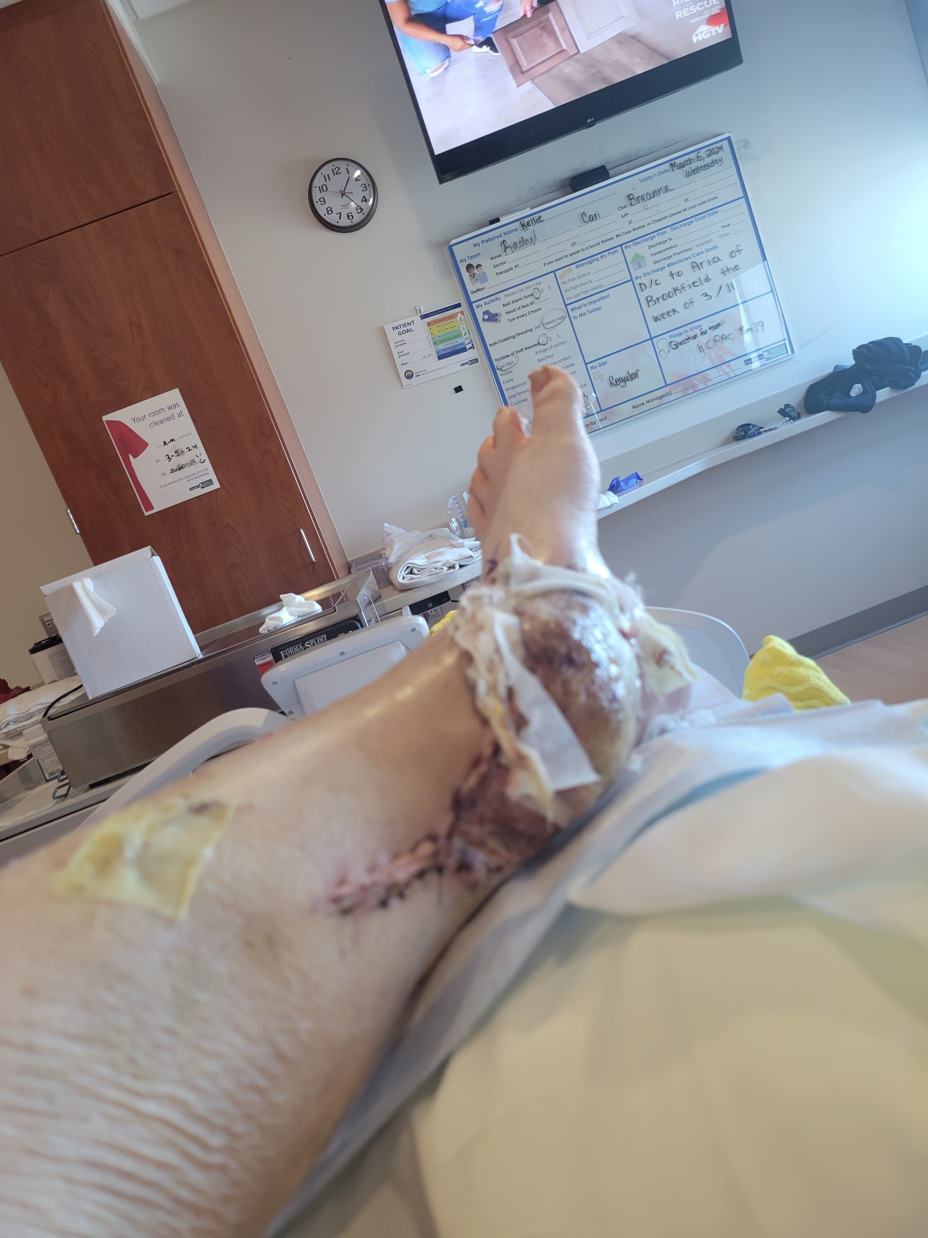 Help Me Recover from 13 Surgeries campaign photo, 2 of 4