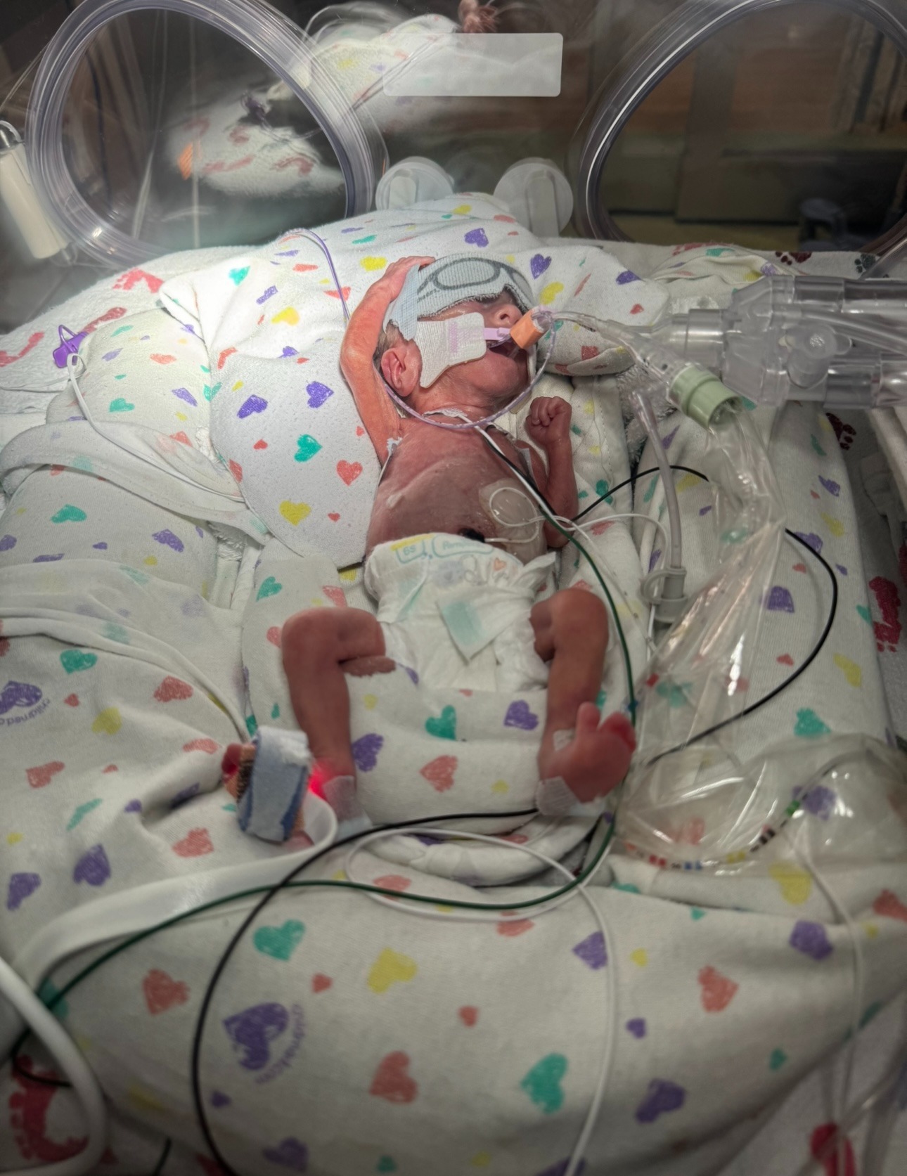 A Lion’s Legacy, His Twin Brother's NICU Fight campaign photo, 7 of 8