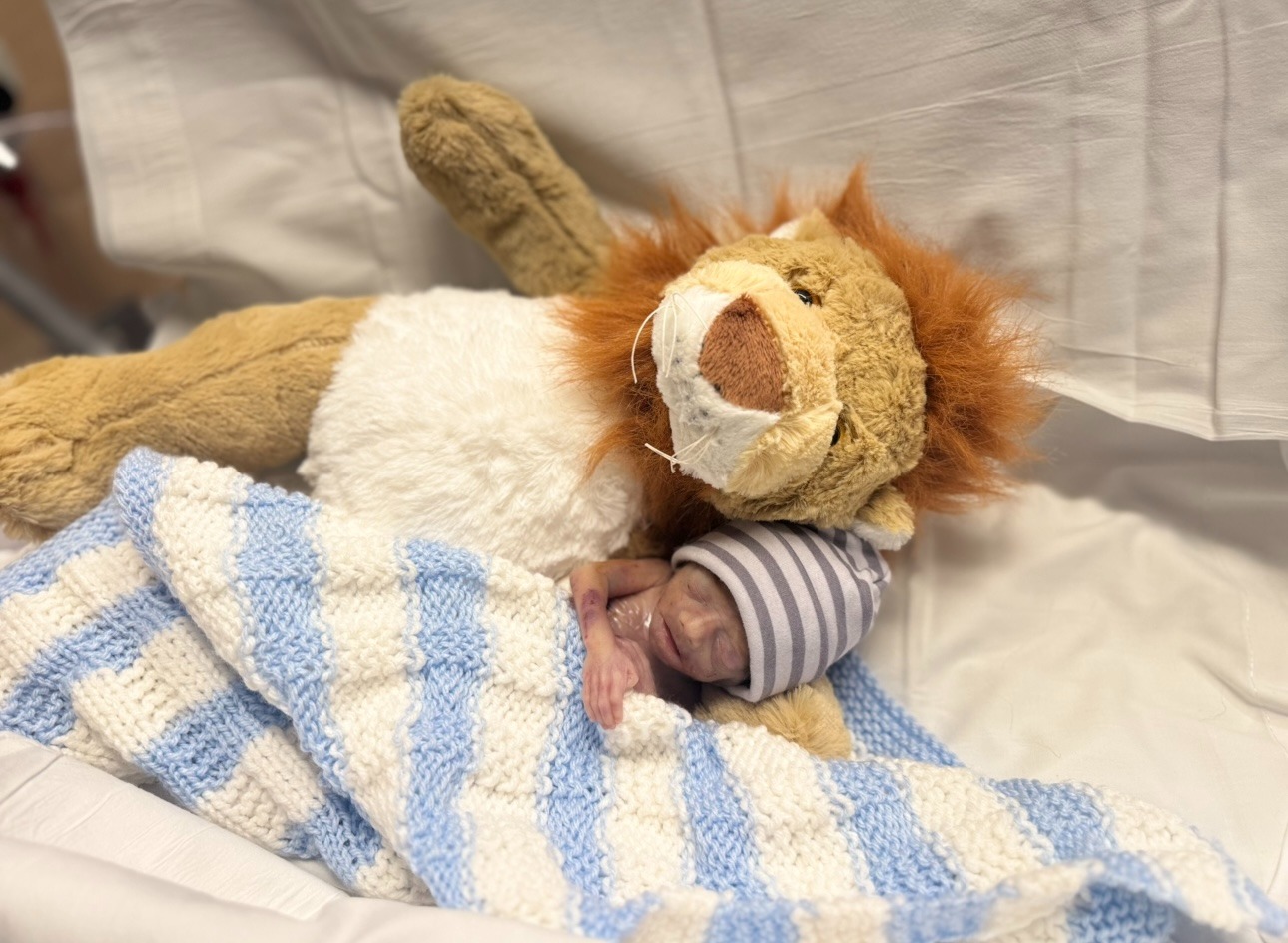 A Lion’s Legacy, His Twin Brother's NICU Fight campaign photo, 2 of 8
