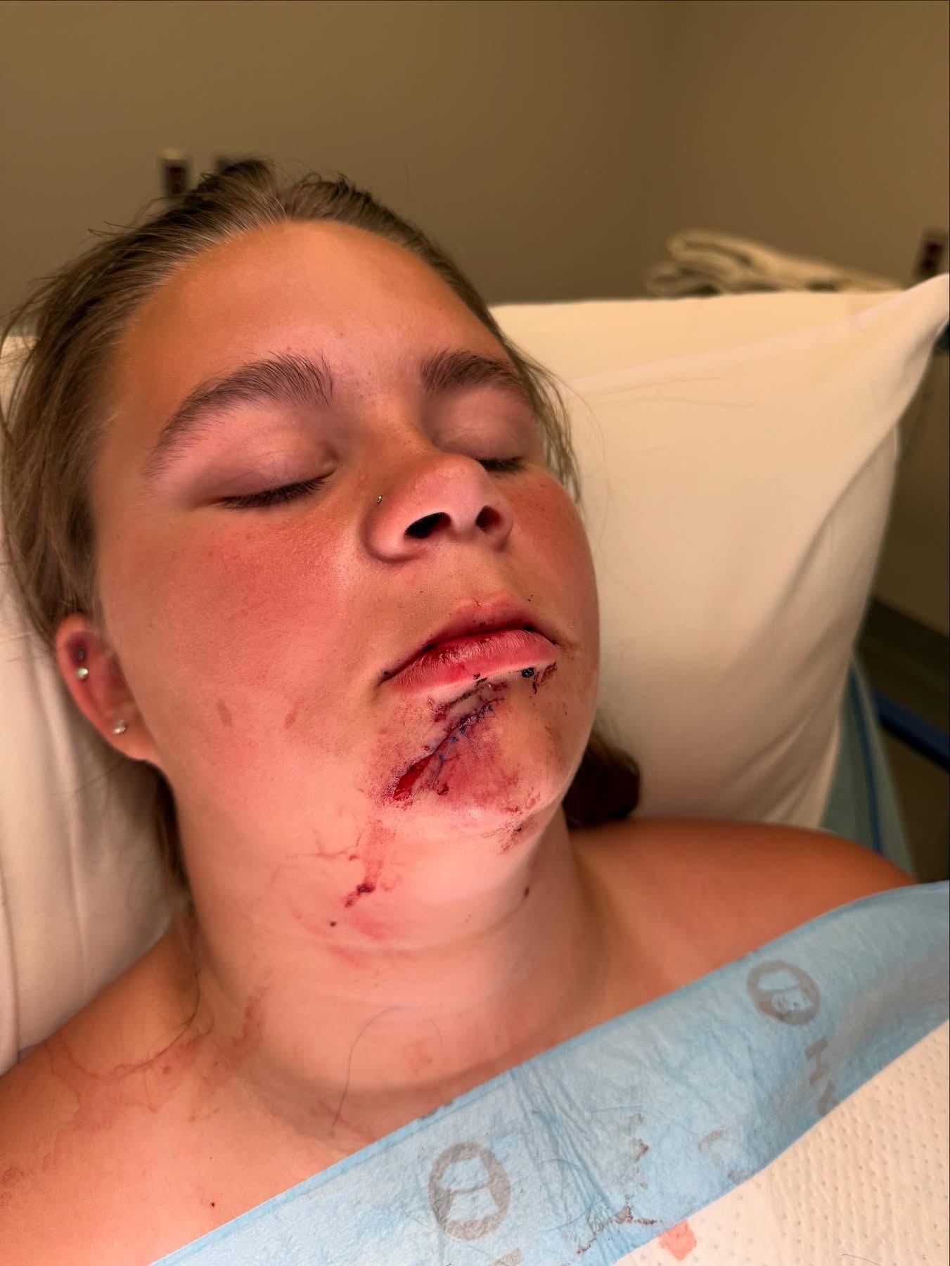 Riley's Recovery: Overcoming Her Injuries campaign photo, 7 of 8