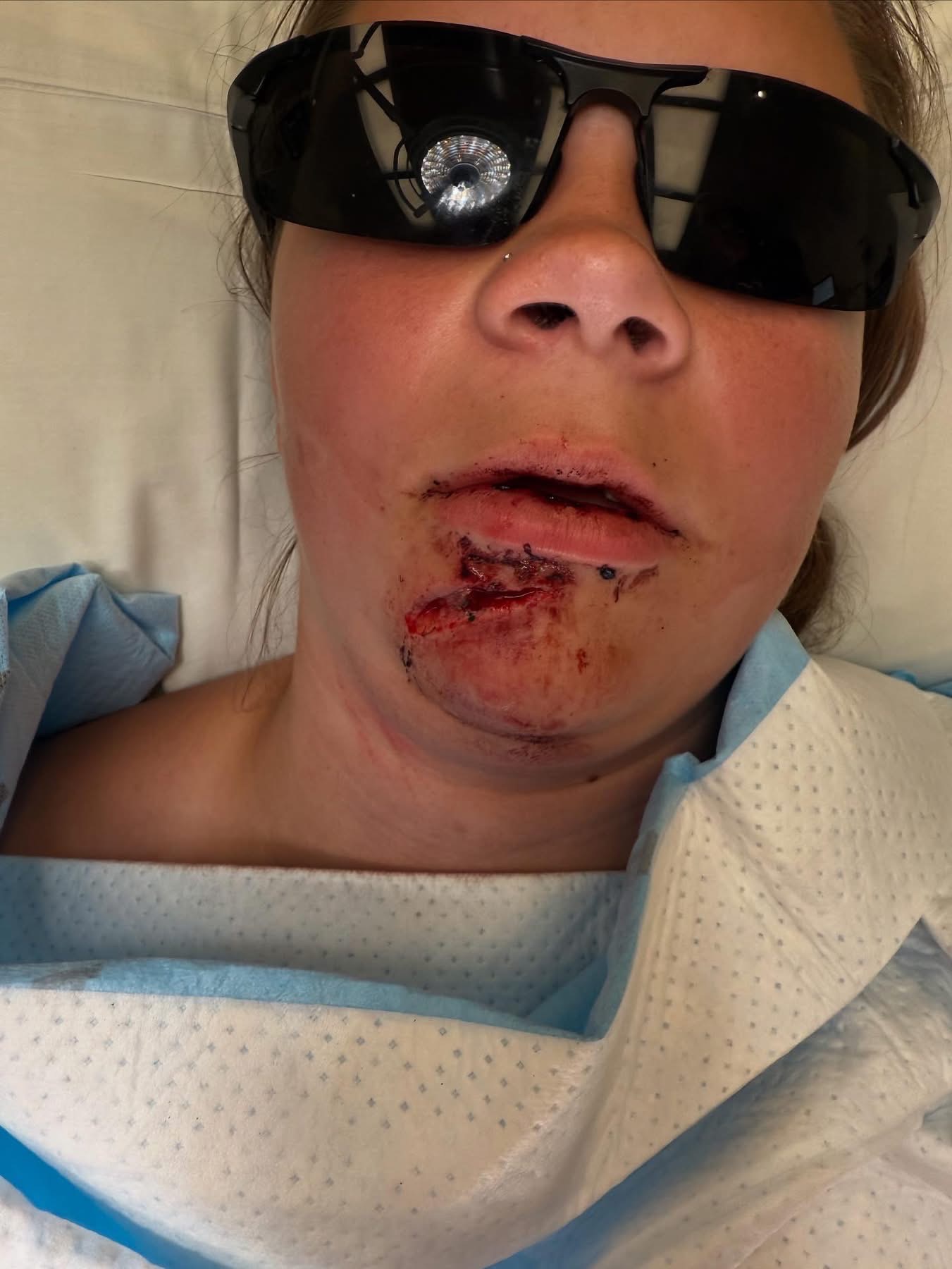 Riley's Recovery: Overcoming Her Injuries campaign photo, 2 of 8
