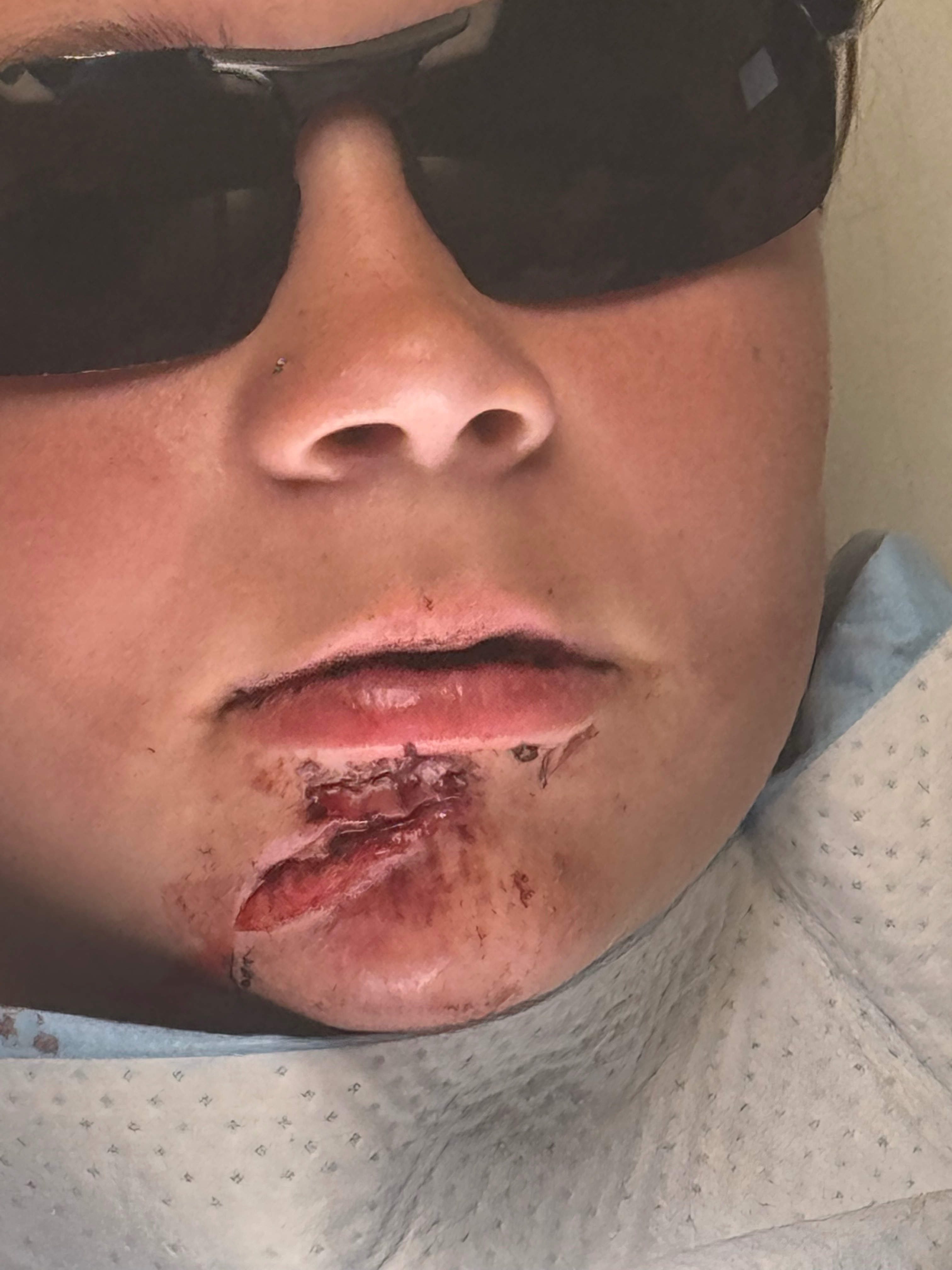 Riley's Recovery: Overcoming Her Injuries campaign photo, 4 of 8
