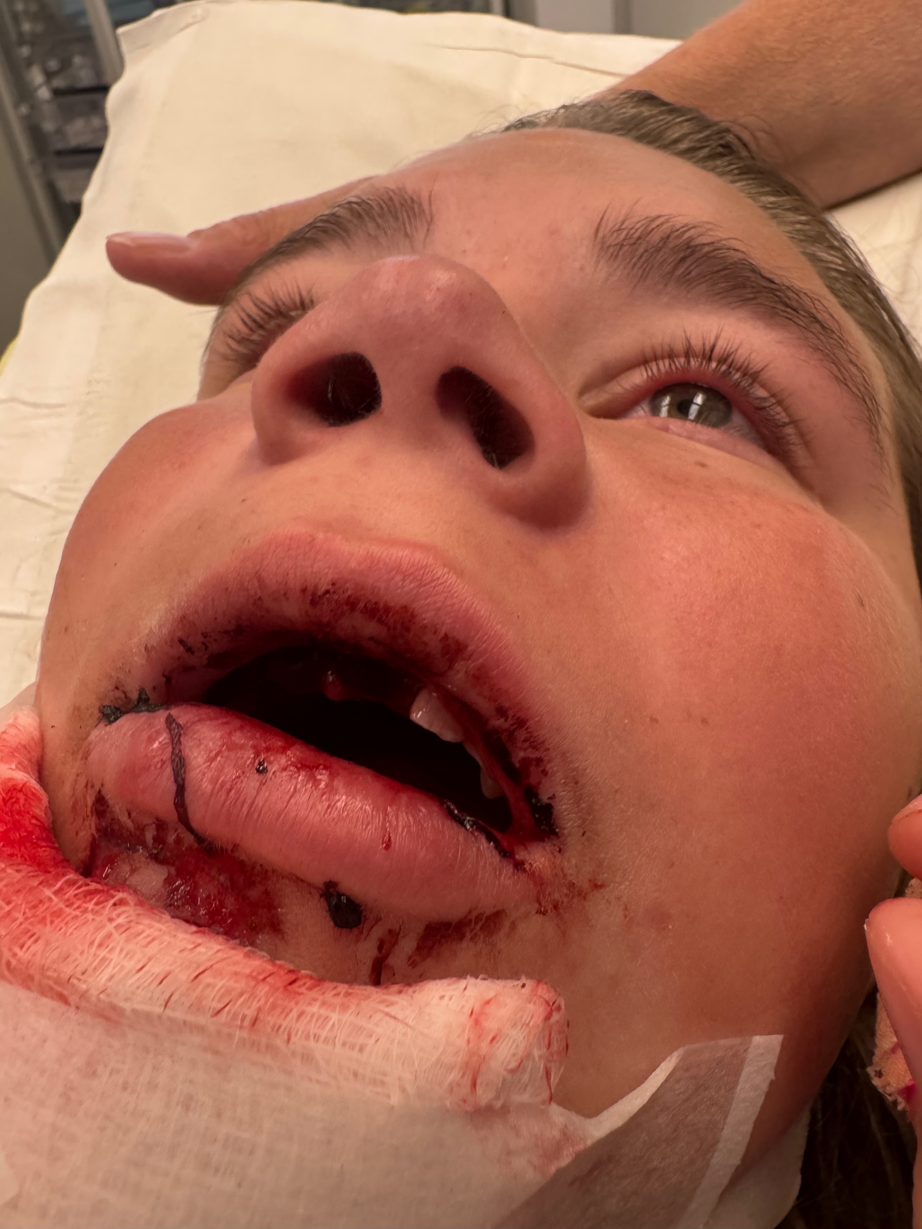 Riley's Recovery: Overcoming Her Injuries campaign photo, 5 of 8