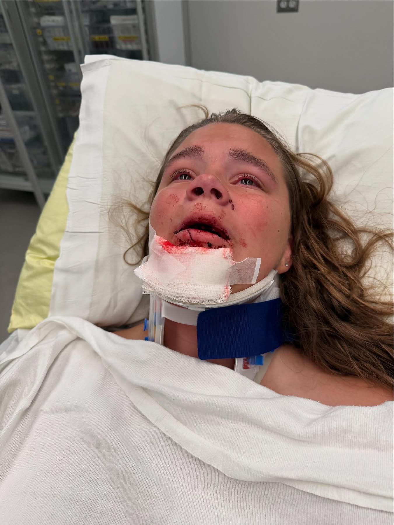 Riley's Recovery: Overcoming Her Injuries campaign photo, 6 of 8