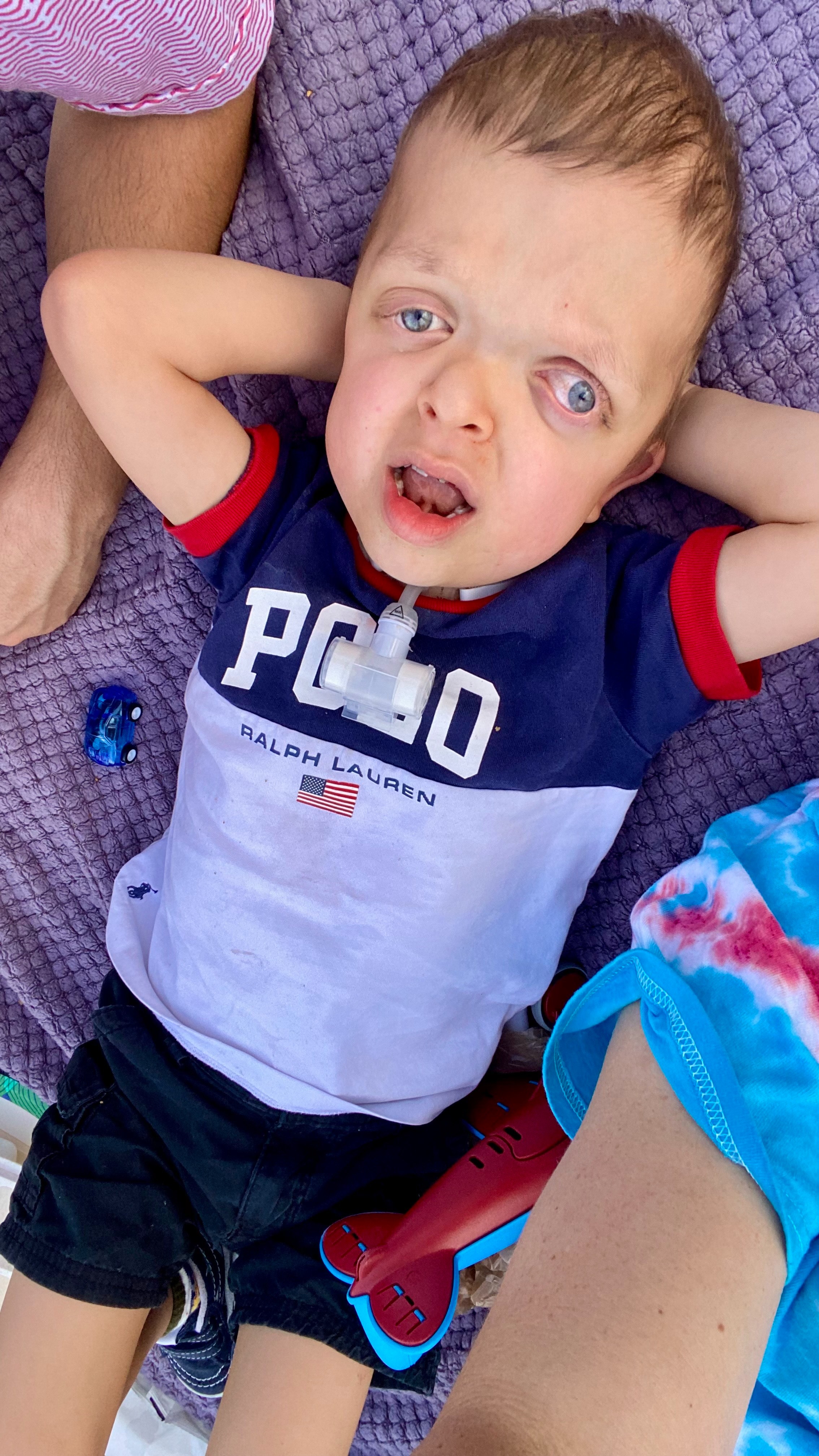 Help Mikey Get the Brain Surgery He Needs campaign photo, 2 of 4