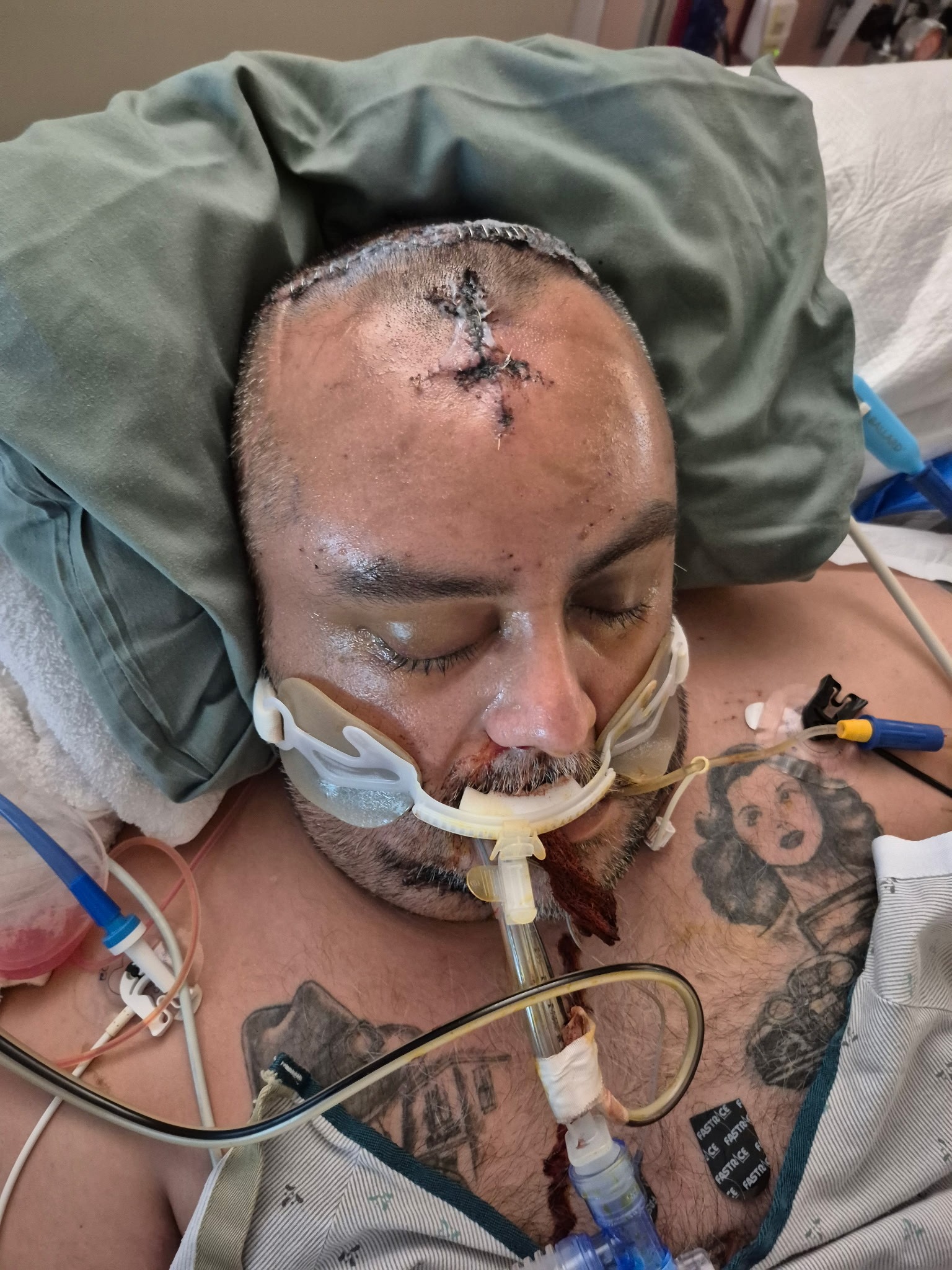 Raul's Recovery: A Family's Hope campaign photo, 5 of 8