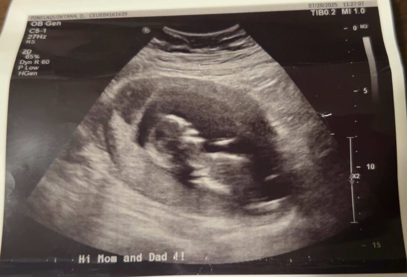 Help Lay Our Angel Baby to Rest campaign photo, 2 of 3