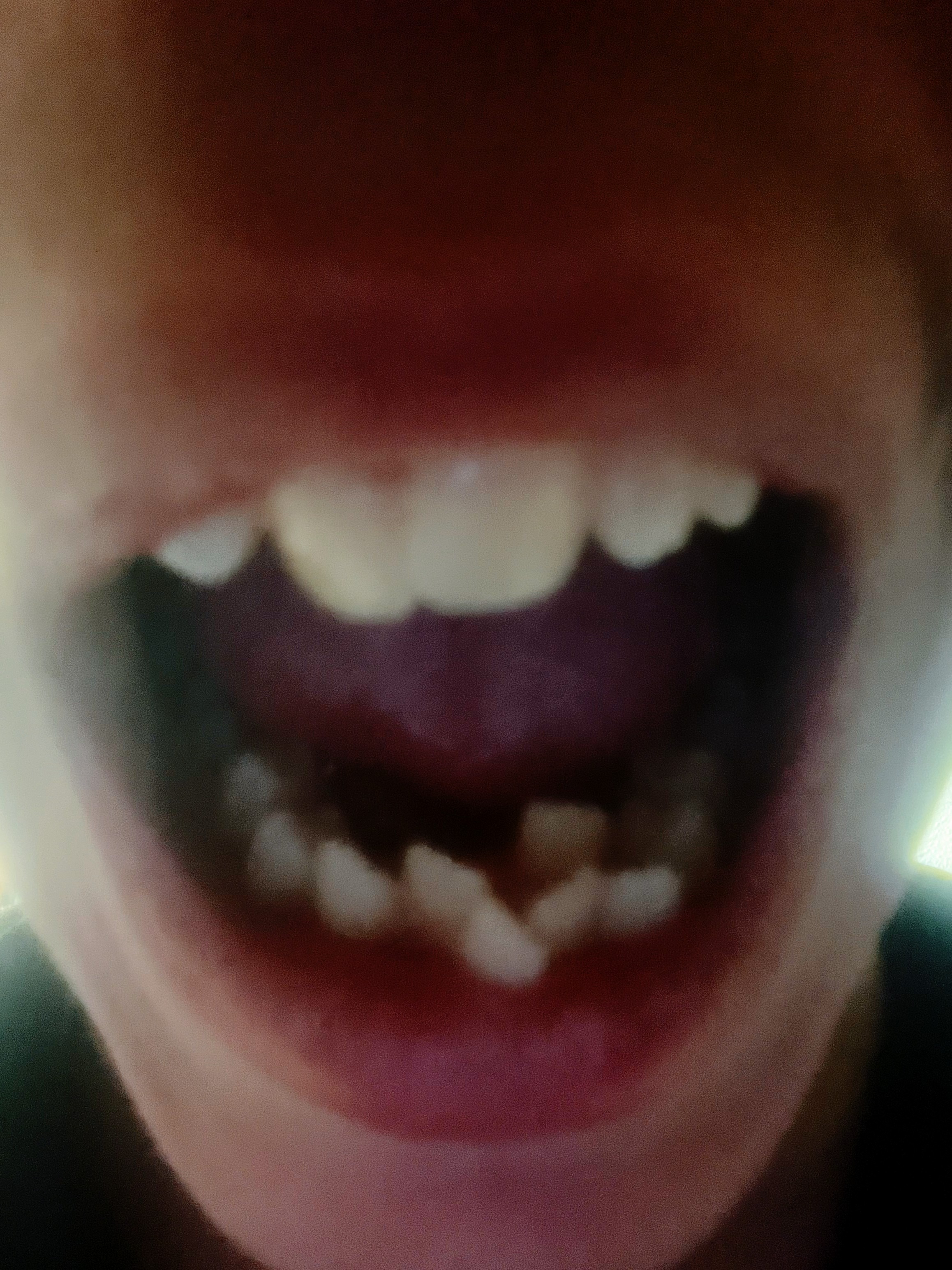 Help Harrison Get Braces – Support for Our Small Family campaign photo, 5 of 8