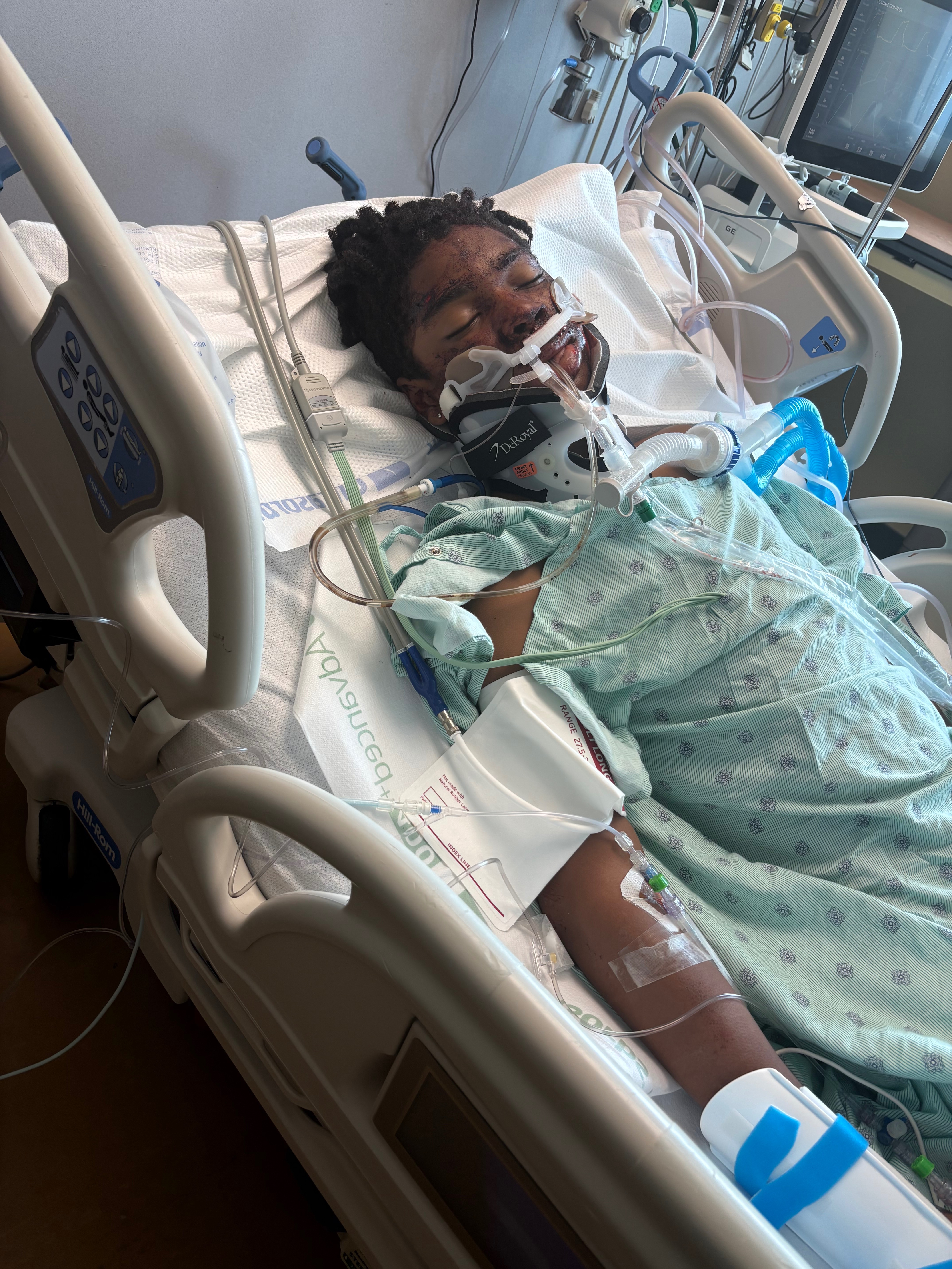Help Harllen Heal After Tragic Accident campaign photo, 6 of 7