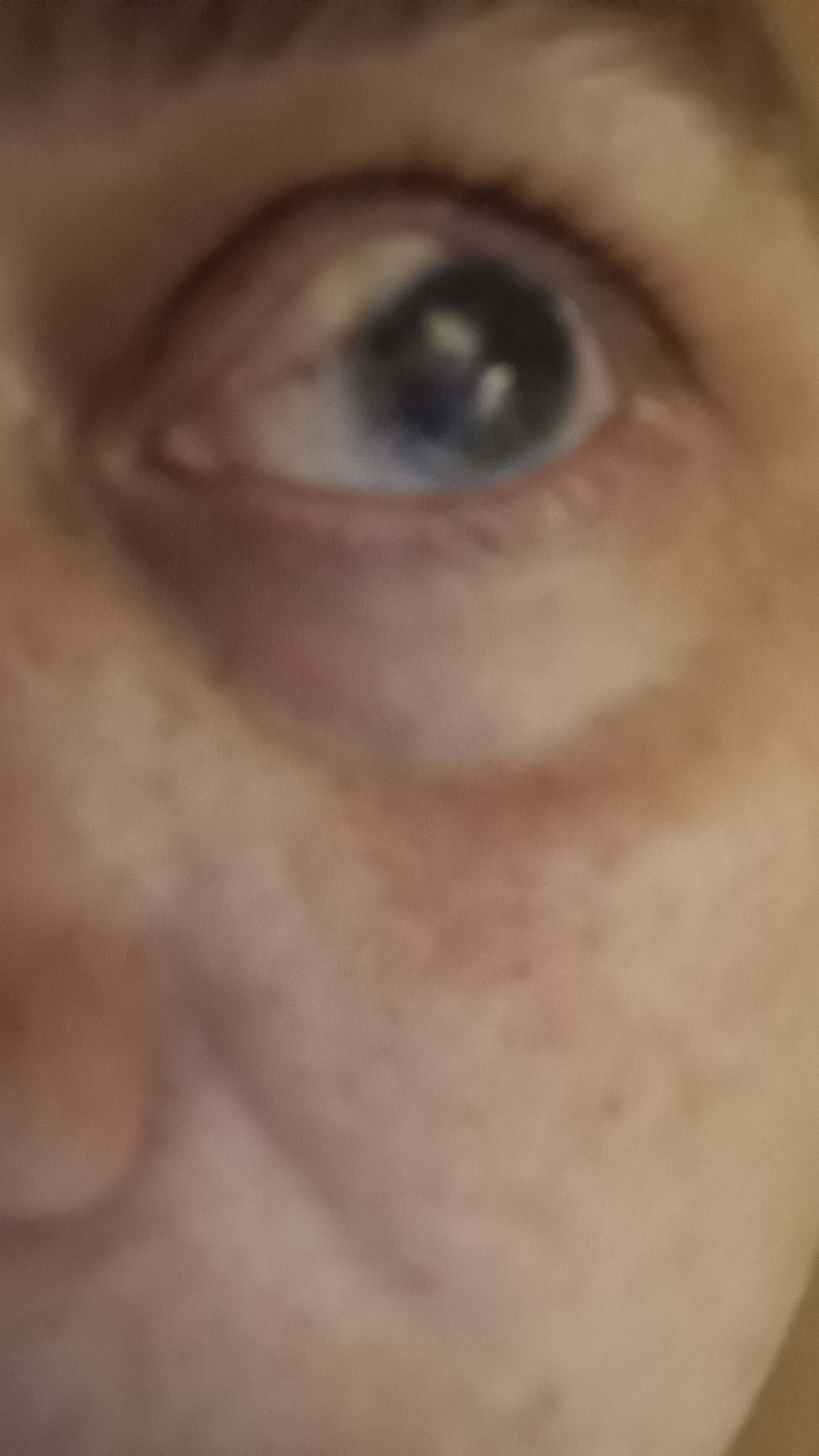 Help Connie cover Surgery Costs from eye removal campaign photo, 7 of 8